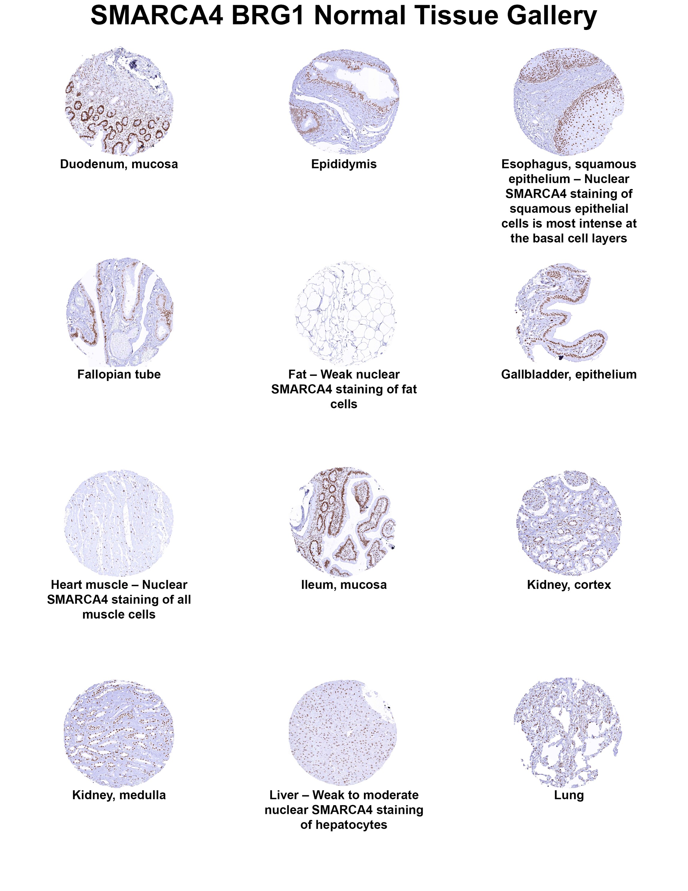 Brg1 Antibody (MSVA-397R) Brg1 Antibody (MSVA-397R) Brg1 Normal Tissue Gallery