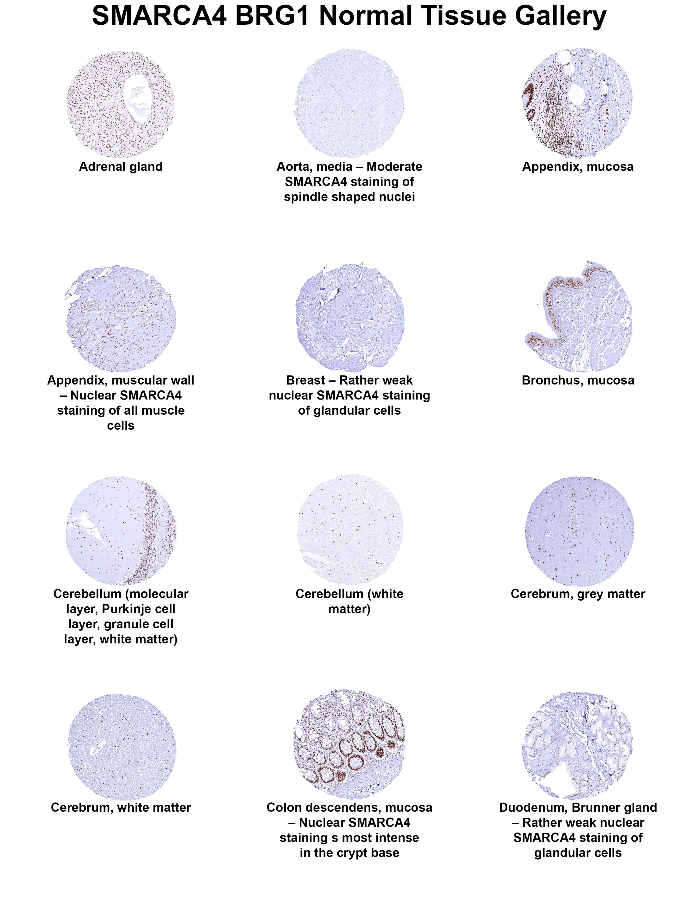 Brg1 Antibody (MSVA-397R) Brg1 Antibody (MSVA-397R) Brg1 Normal Tissue Gallery