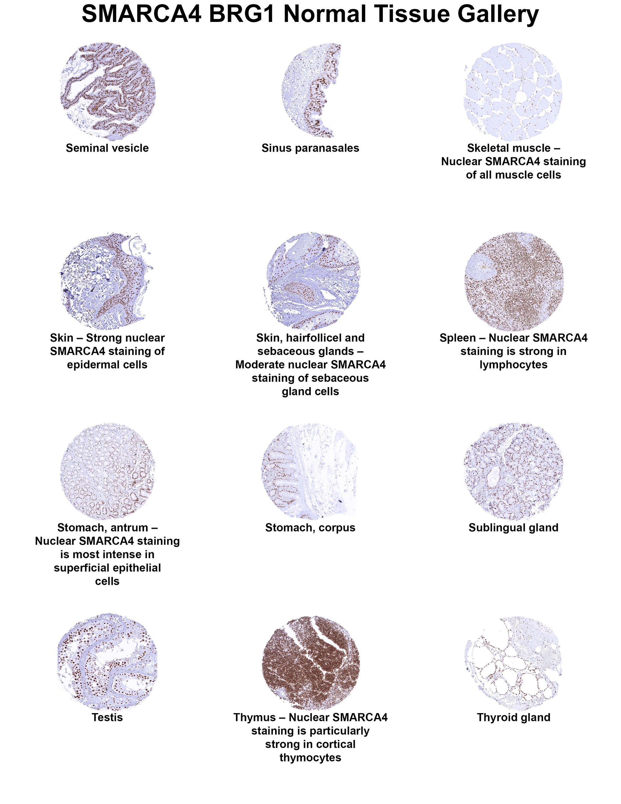 Brg1 Antibody (MSVA-397R) Brg1 Antibody (MSVA-397R) Brg1 Normal Tissue Gallery