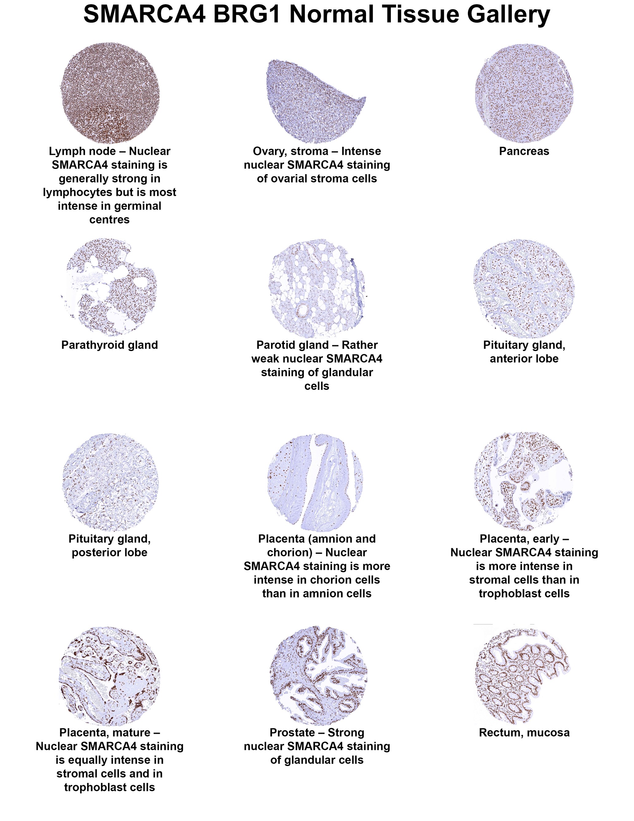 Brg1 Antibody (MSVA-397R) Brg1 Antibody (MSVA-397R) Brg1 Normal Tissue Gallery