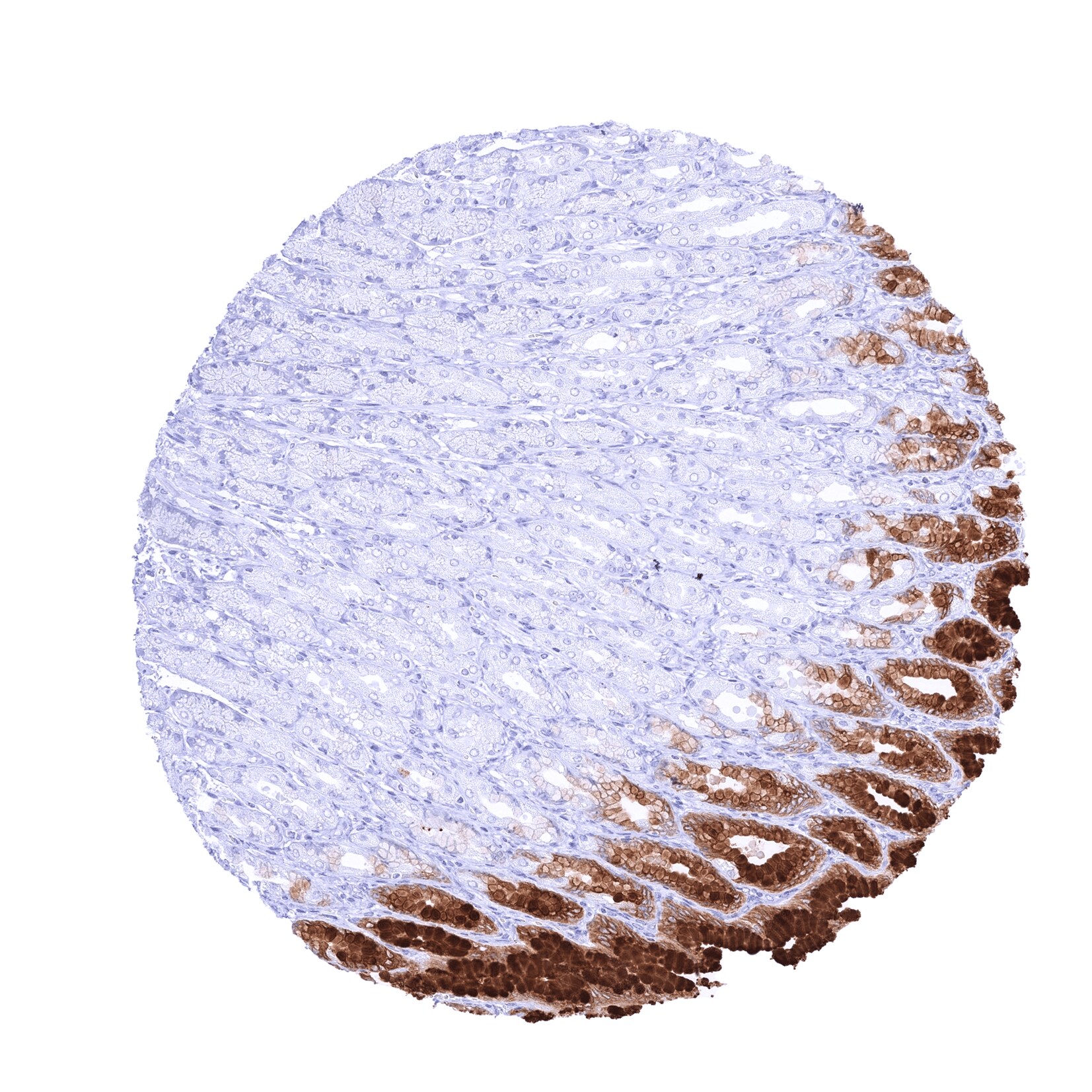 TFF1/pS2 Antibody (MSVA-482M)