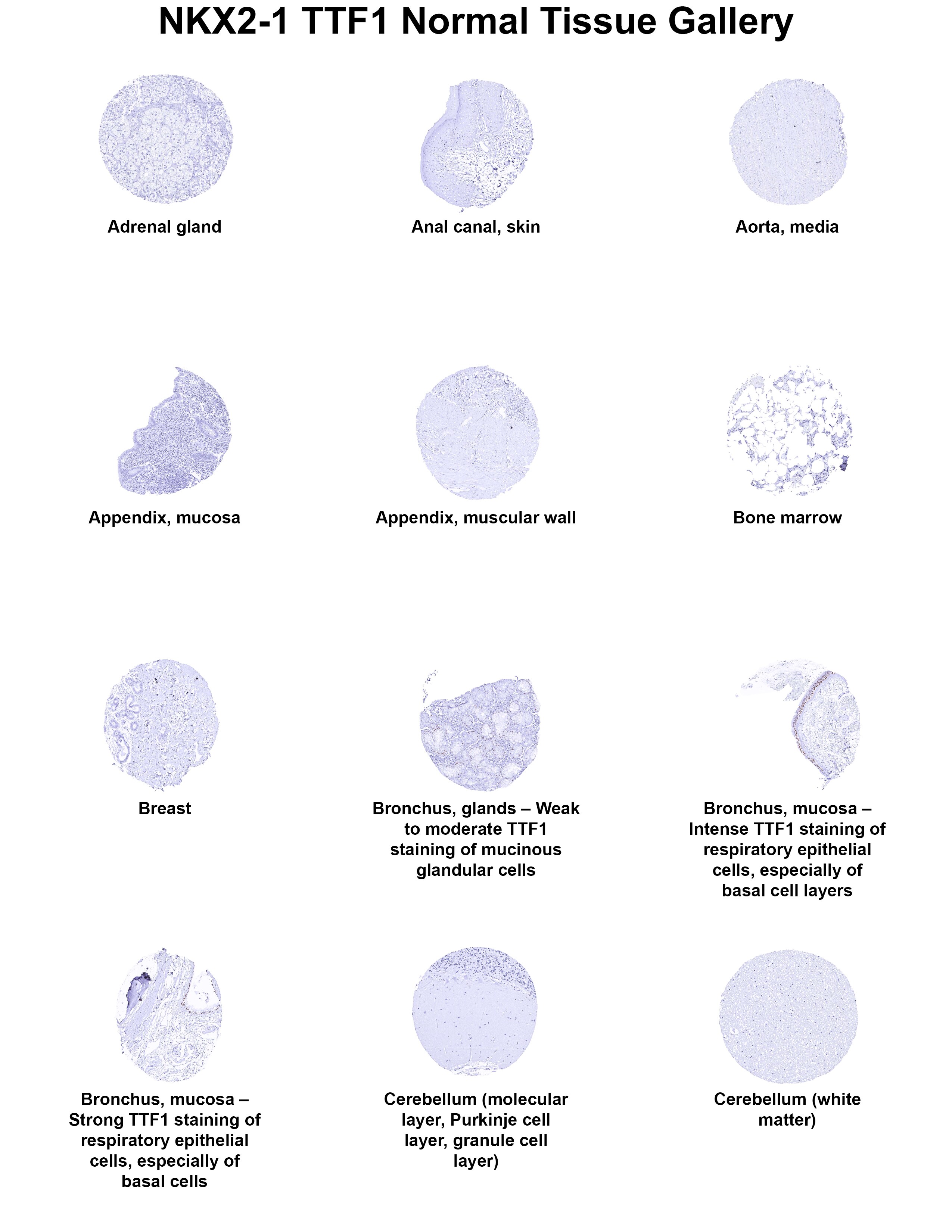 TTF-1 / NKX2-1 Antibody (MSVA-312R) TTF-1 / NKX2-1 Antibody (MSVA-312R) TTF-1 / NKX2-1 Normal Tissue Gallery
