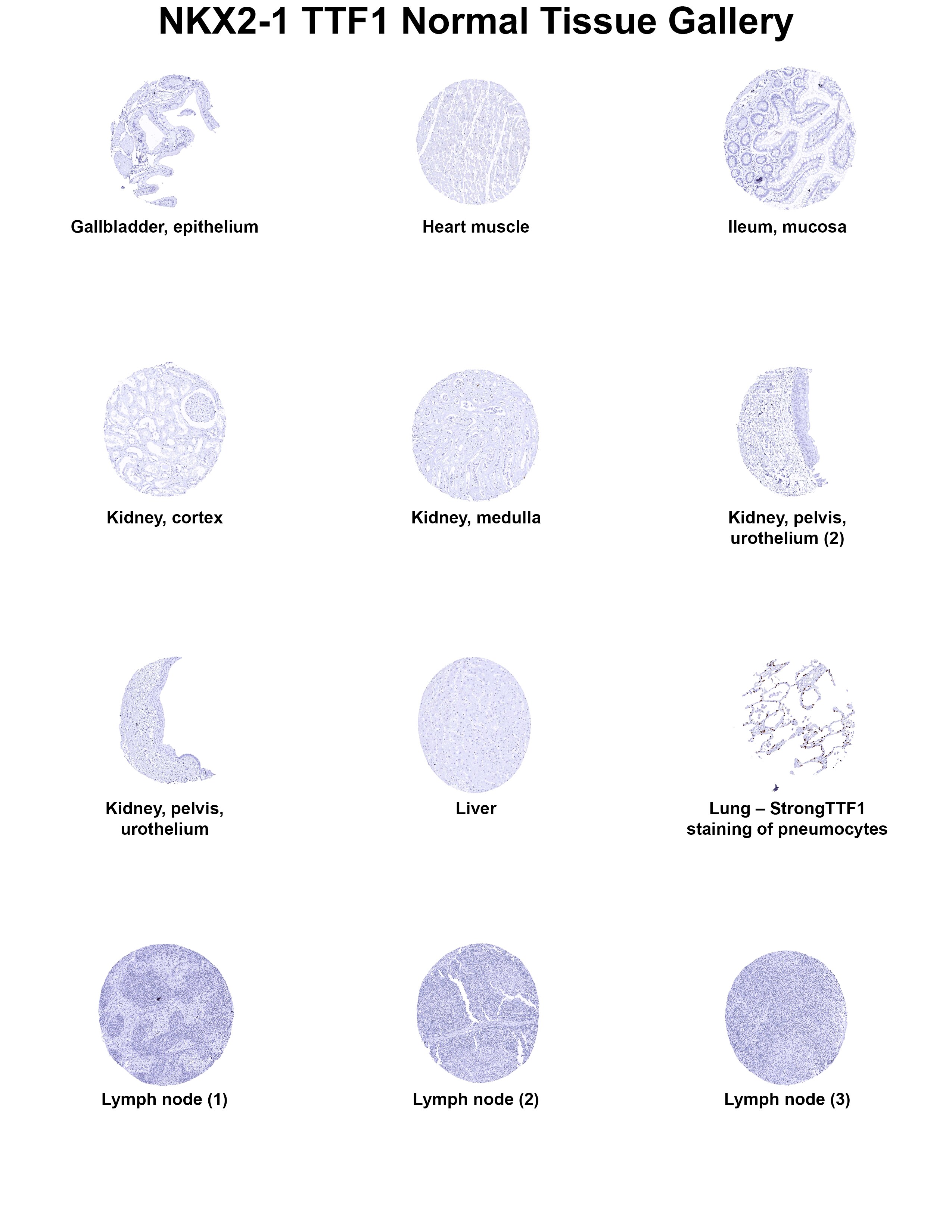 TTF-1 / NKX2-1 Antibody (MSVA-312R) TTF-1 / NKX2-1 Antibody (MSVA-312R) TTF-1 / NKX2-1 Normal Tissue Gallery