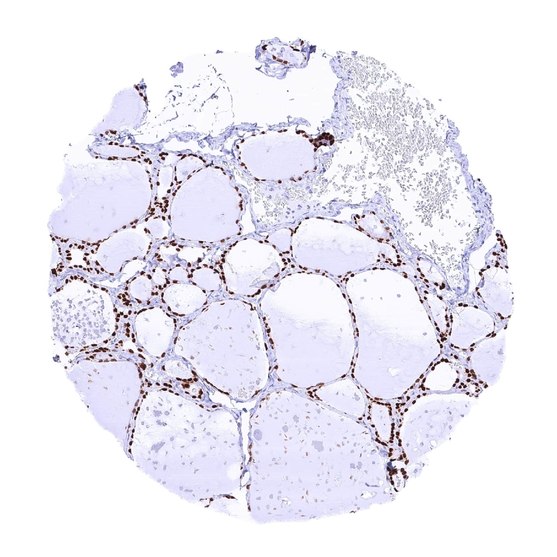 TTF-1 / NKX2-1 Antibody (MSVA-312R)
