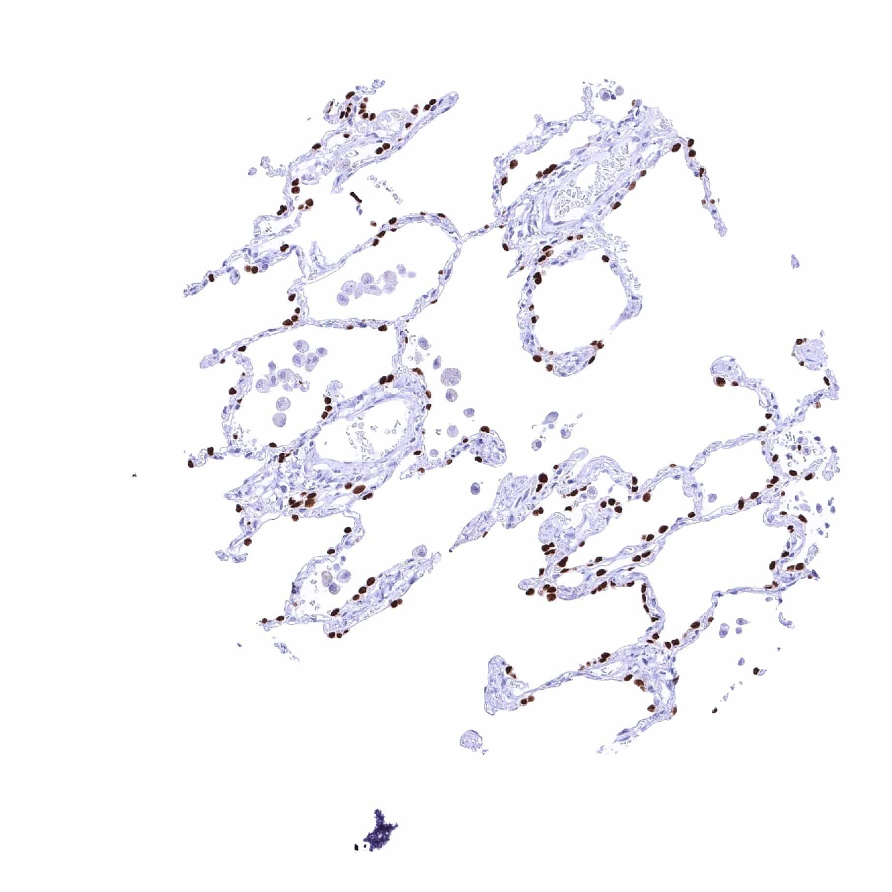 TTF-1 / NKX2-1 Antibody (MSVA-312R)
