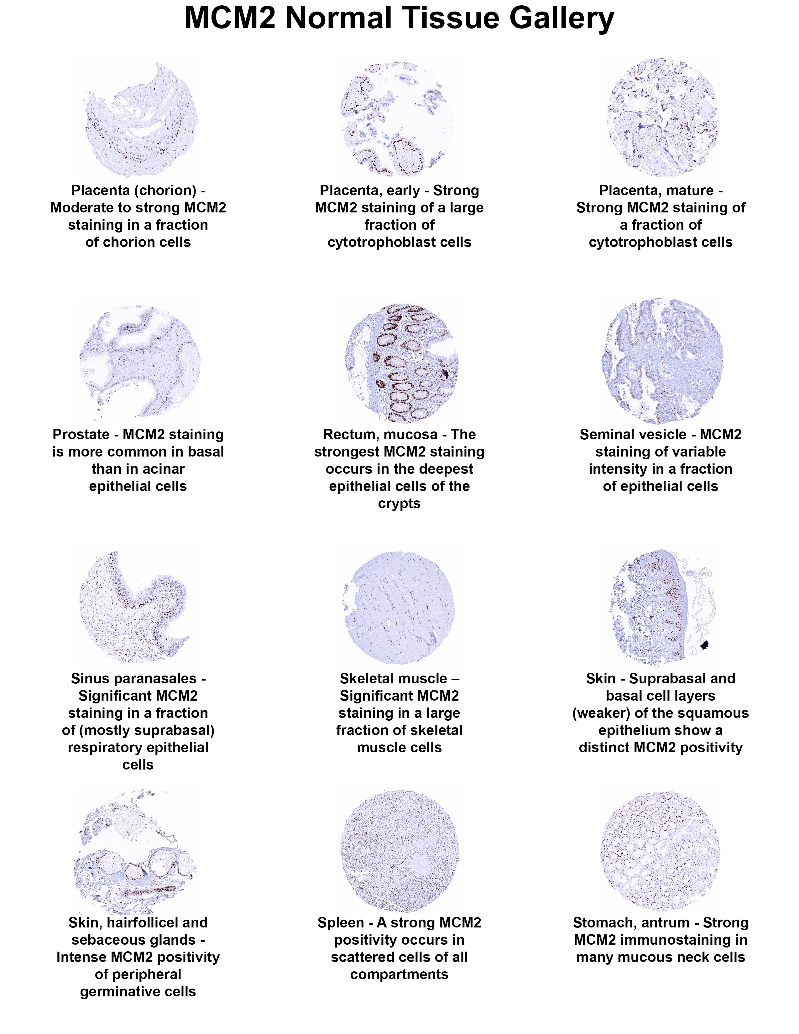 MCM2 Antibody (MSVA-502R) MCM2 Antibody (MSVA-502R) MCM2 Normal Tissue Gallery