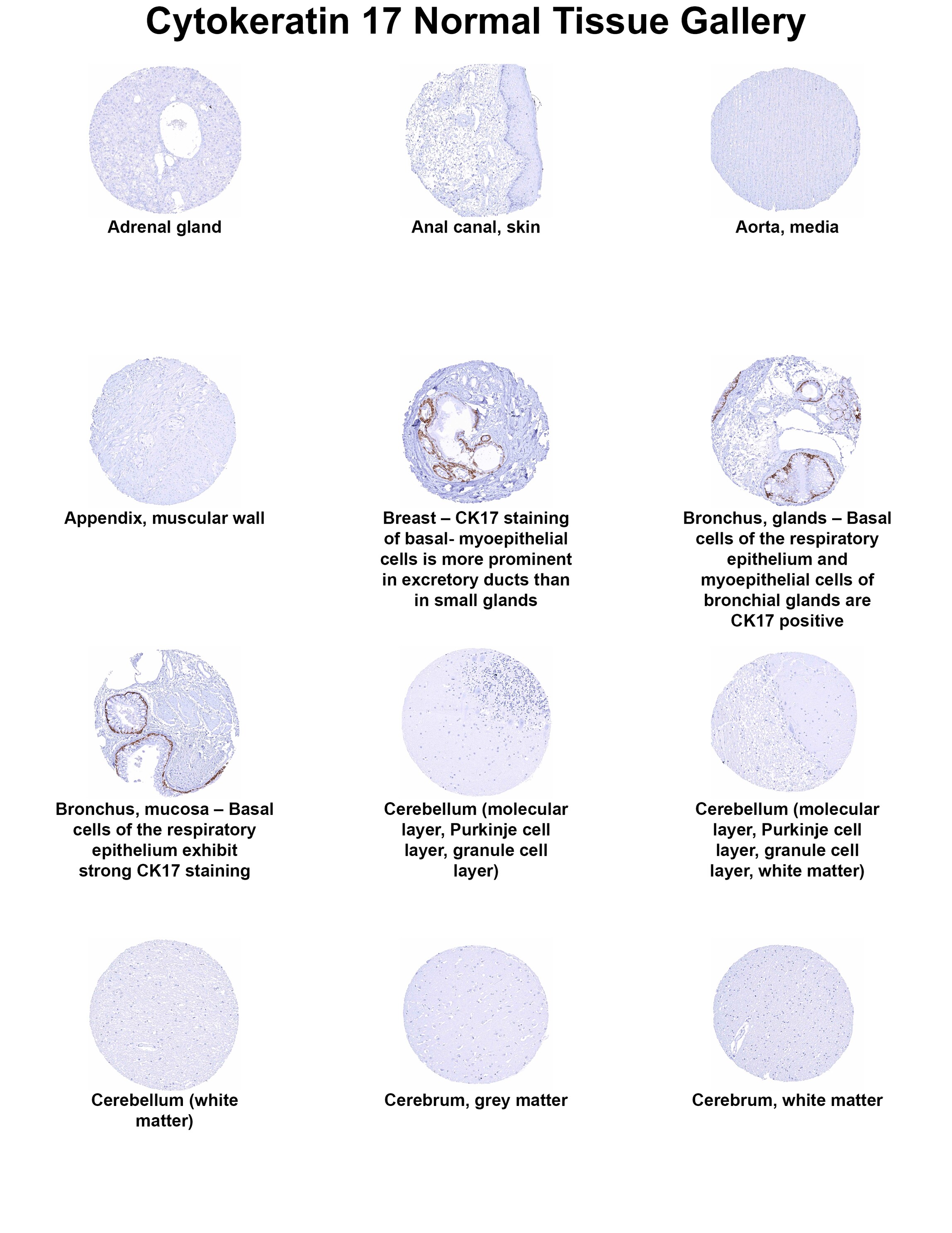 Cytokeratin 17 Antibody (MSVA-117R) Cytokeratin 17 Antibody (MSVA-117R) Cytokeratin 17 Normal Tissue Gallery