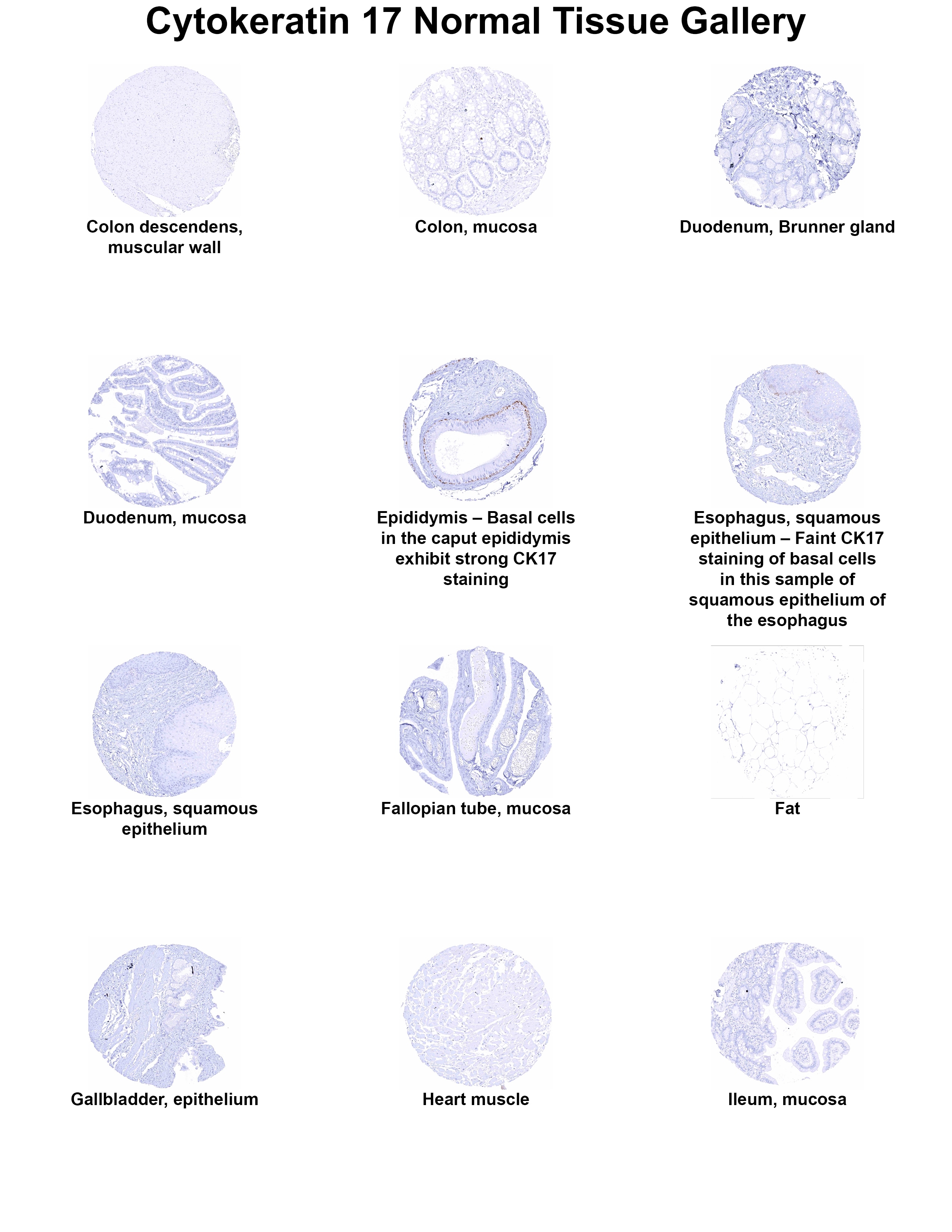 Cytokeratin 17 Antibody (MSVA-117R) Cytokeratin 17 Antibody (MSVA-117R) Cytokeratin 17 Normal Tissue Gallery