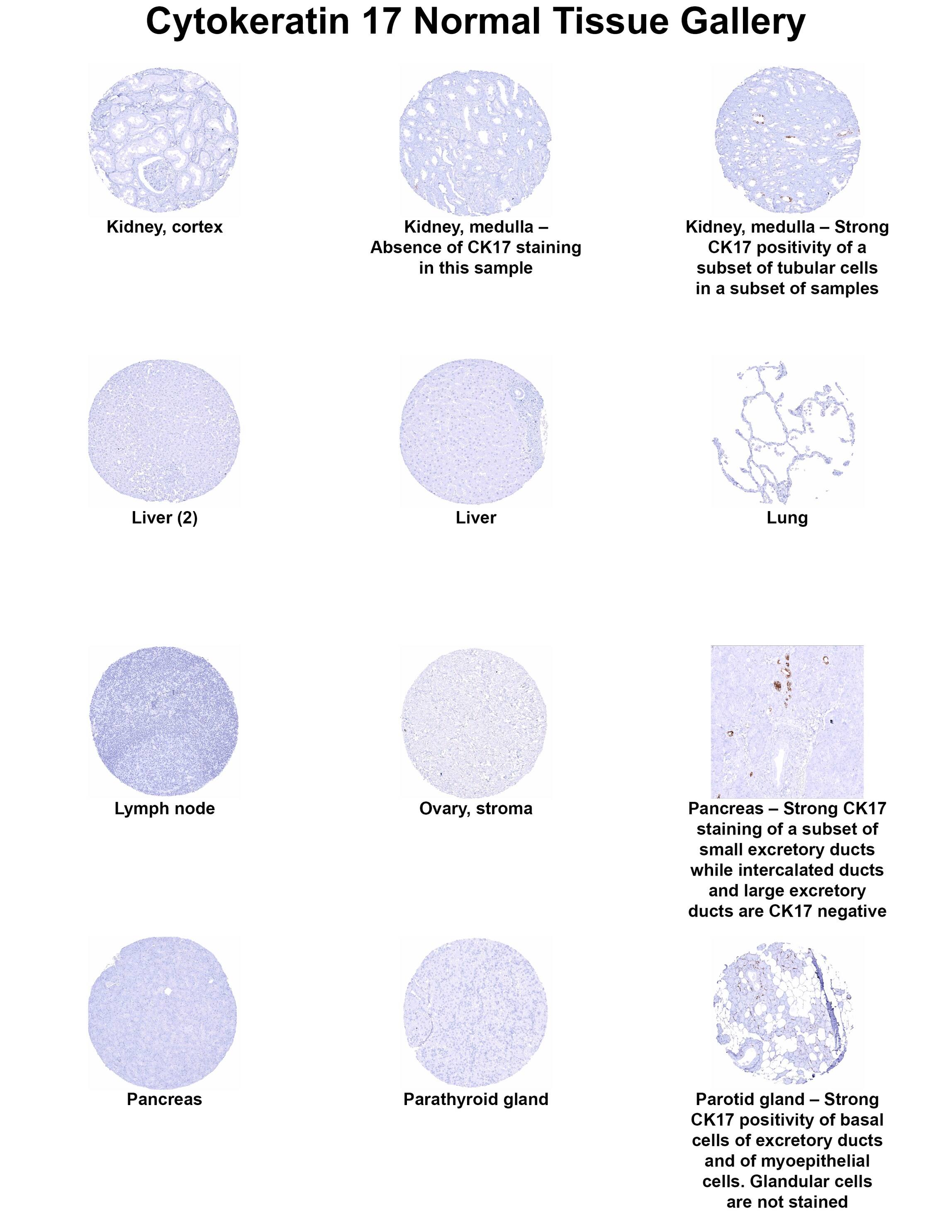 Cytokeratin 17 Antibody (MSVA-117R) Cytokeratin 17 Antibody (MSVA-117R) Cytokeratin 17 Normal Tissue Gallery
