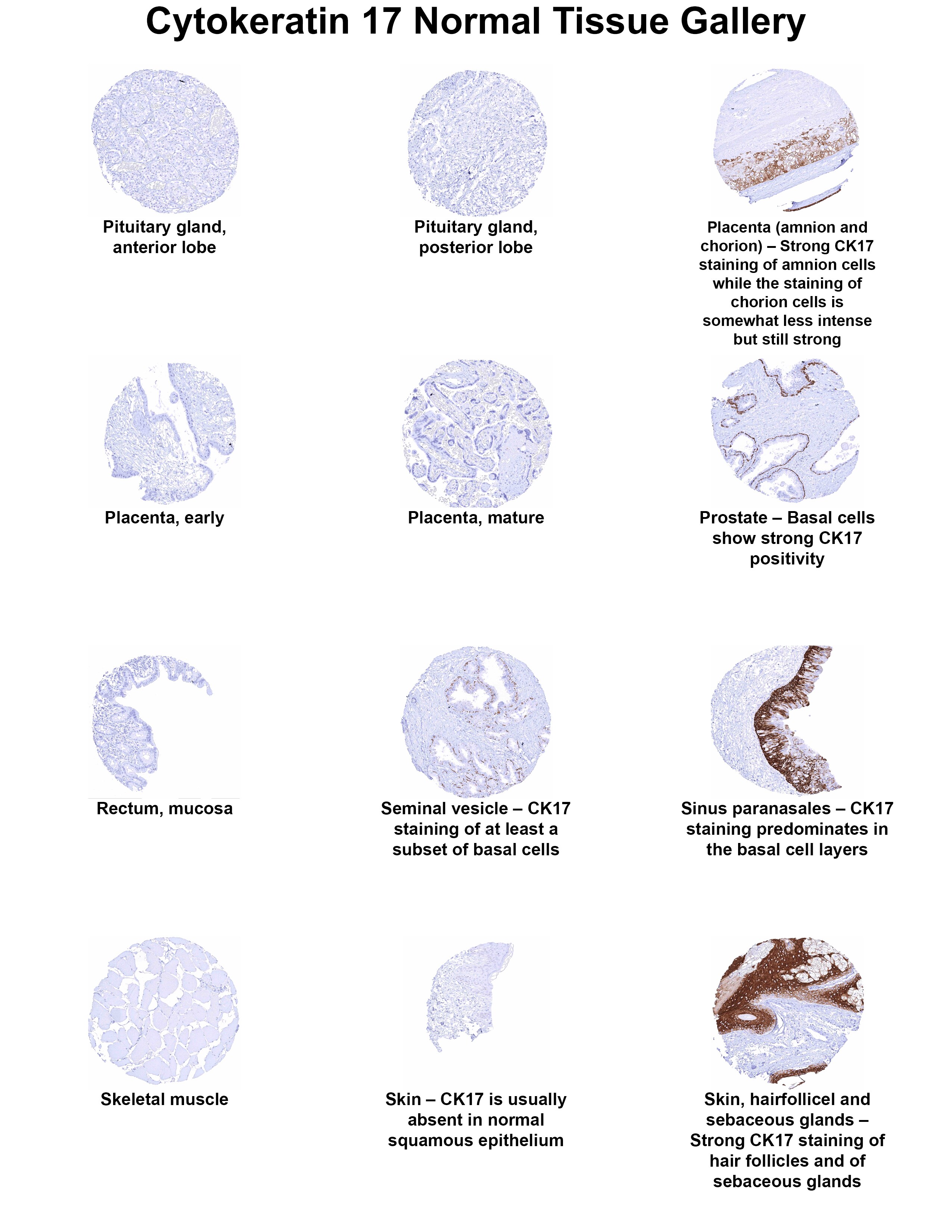 Cytokeratin 17 Antibody (MSVA-117R) Cytokeratin 17 Antibody (MSVA-117R) Cytokeratin 17 Normal Tissue Gallery
