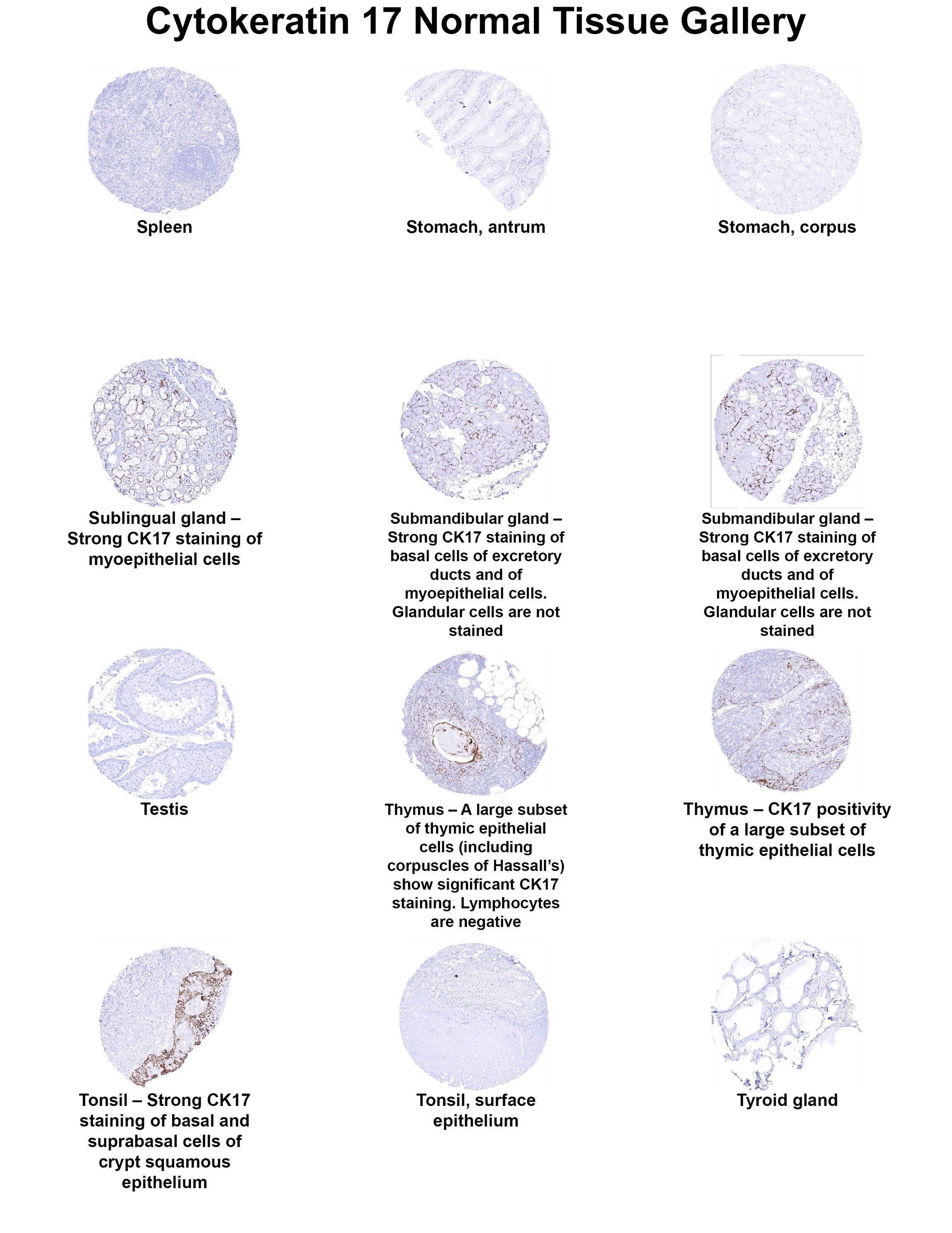 Cytokeratin 17 Antibody (MSVA-117R) Cytokeratin 17 Antibody (MSVA-117R) Cytokeratin 17 Normal Tissue Gallery