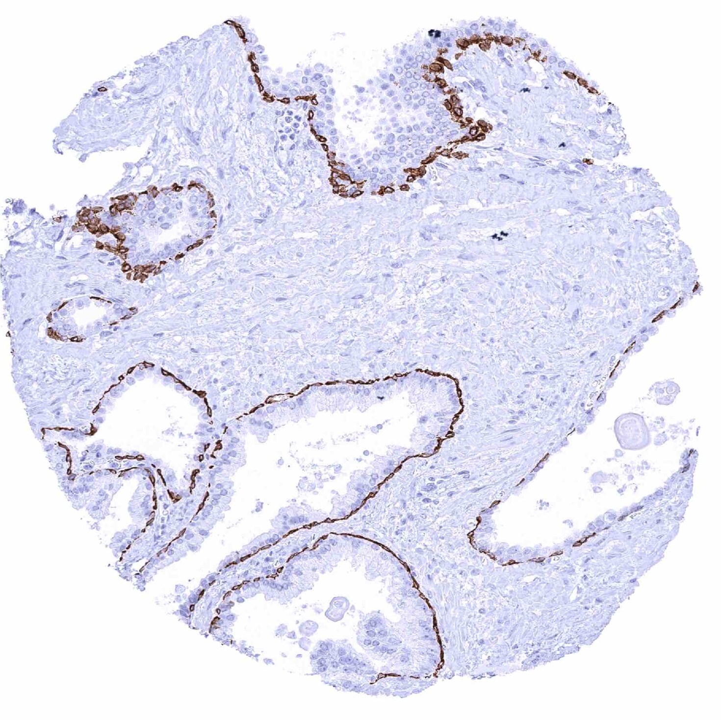 Cytokeratin 17 Antibody (MSVA-117R)