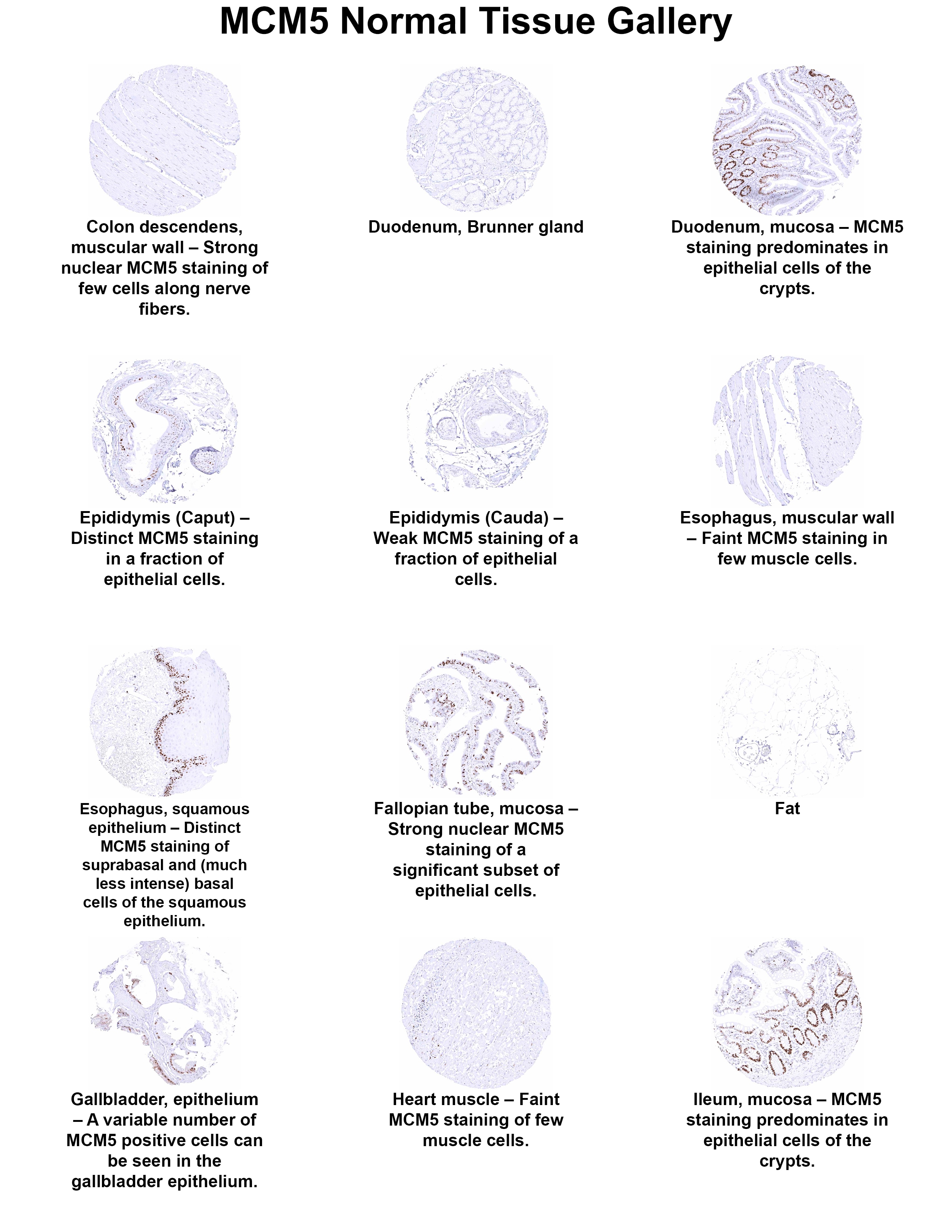 MCM5 Antibody (MSVA-505R) MCM5 Antibody (MSVA-505R) MCM5 Normal Tissue Gallery
