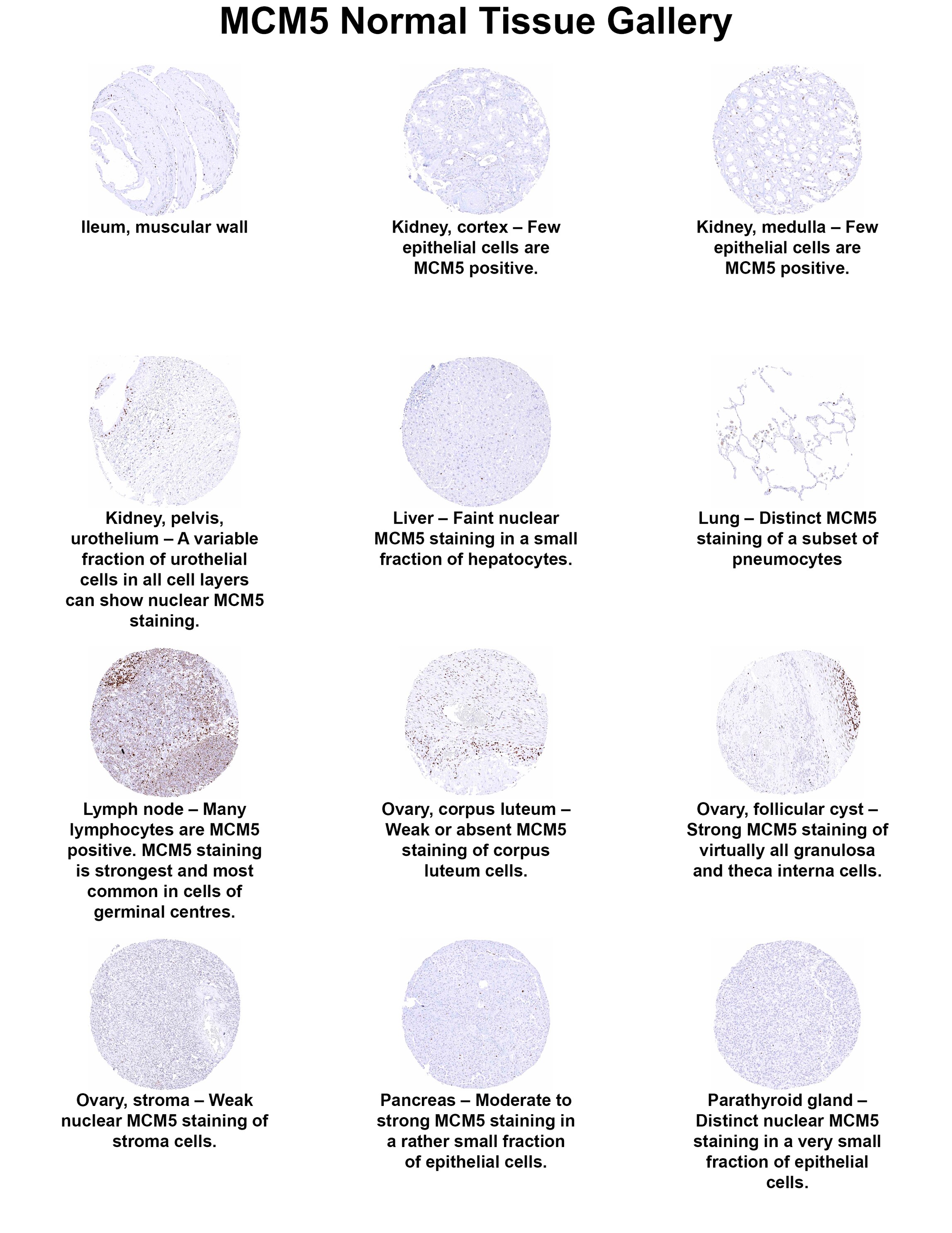 MCM5 Antibody (MSVA-505R) MCM5 Antibody (MSVA-505R) MCM5 Normal Tissue Gallery