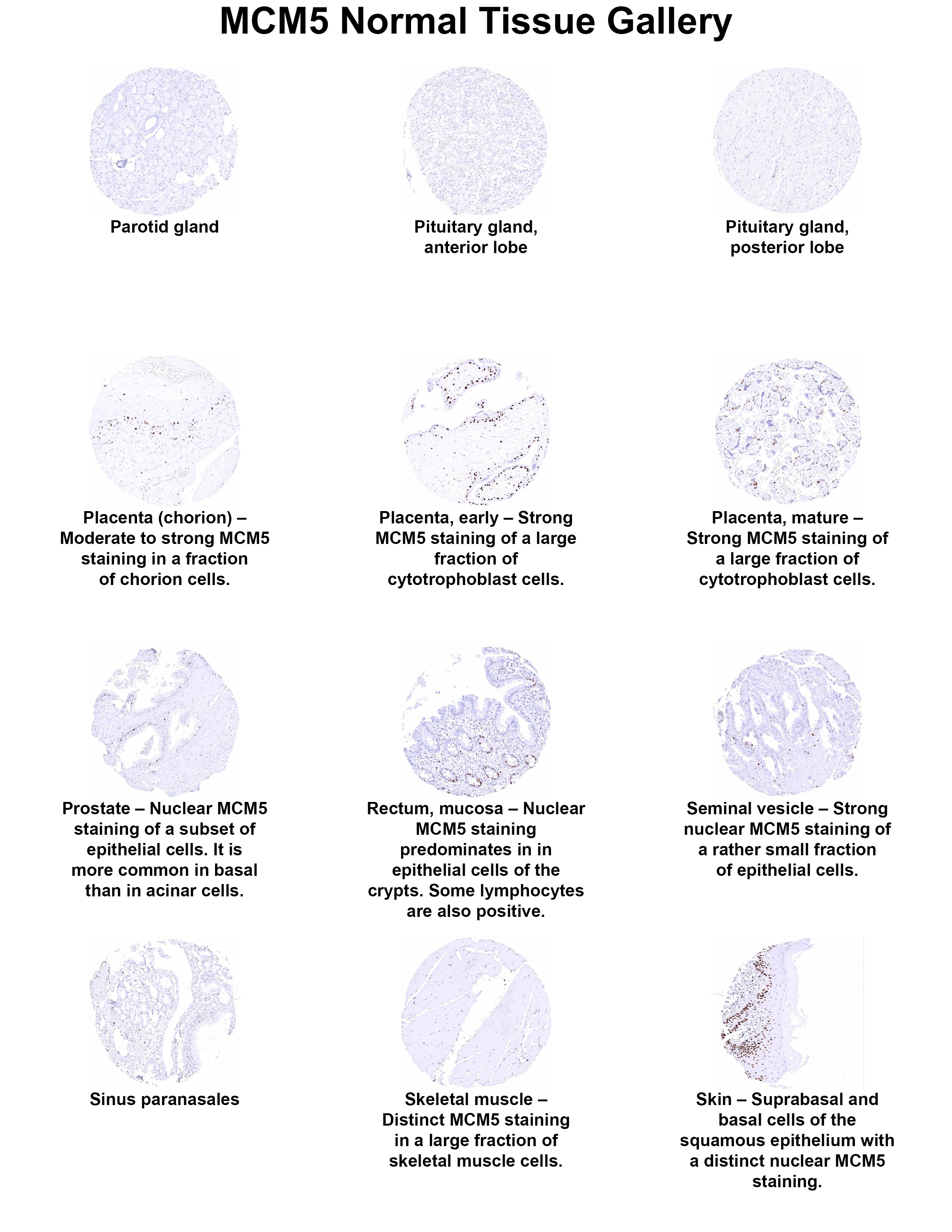 MCM5 Antibody (MSVA-505R) MCM5 Antibody (MSVA-505R) MCM5 Normal Tissue Gallery