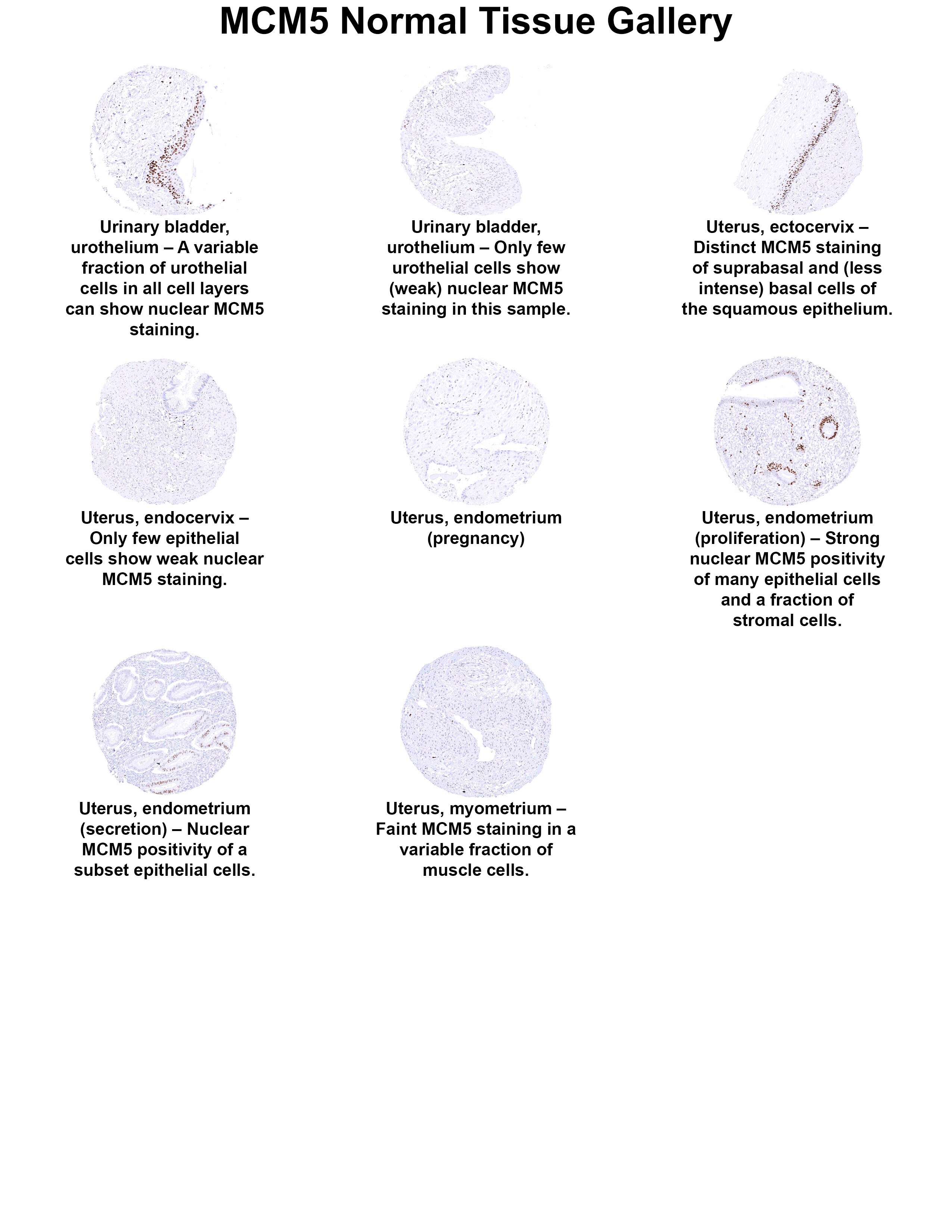 MCM5 Antibody (MSVA-505R) MCM5 Antibody (MSVA-505R) MCM5 Normal Tissue Gallery