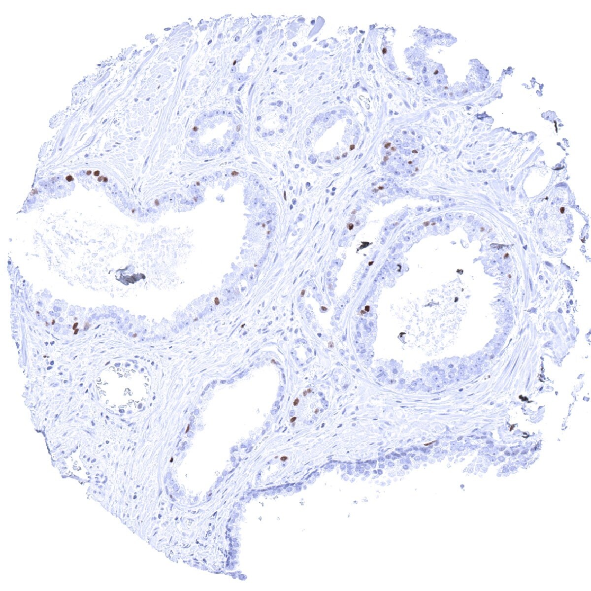 MCM5 Antibody (MSVA-505R)