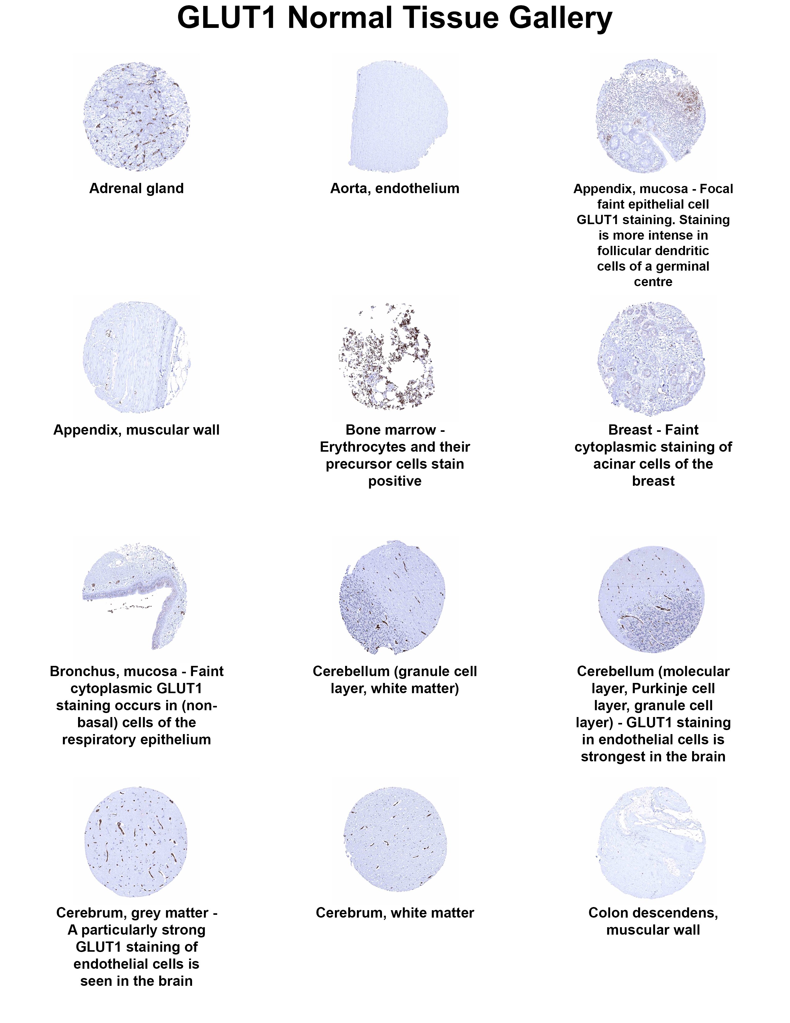 Glut1 Antibody (MSVA-401R) - Azide and BSA Free Glut1 Antibody (MSVA-401R) - Azide and BSA Free Glut1 Normal Tissue Gallery