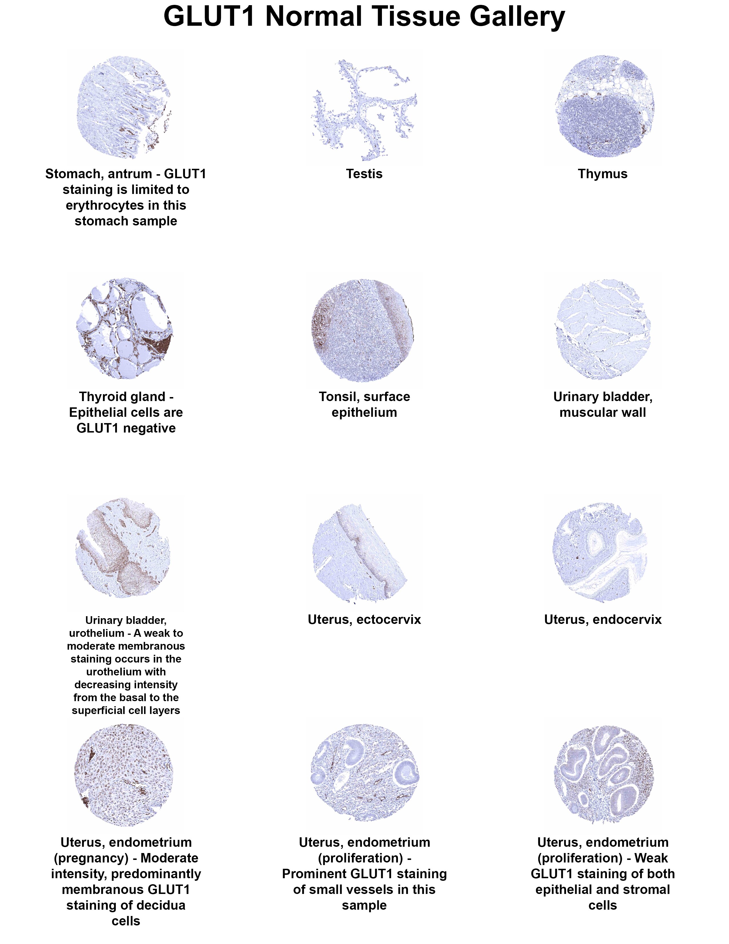 Glut1 Antibody (MSVA-401R) - Azide and BSA Free Glut1 Antibody (MSVA-401R) - Azide and BSA Free Glut1 Normal Tissue Gallery