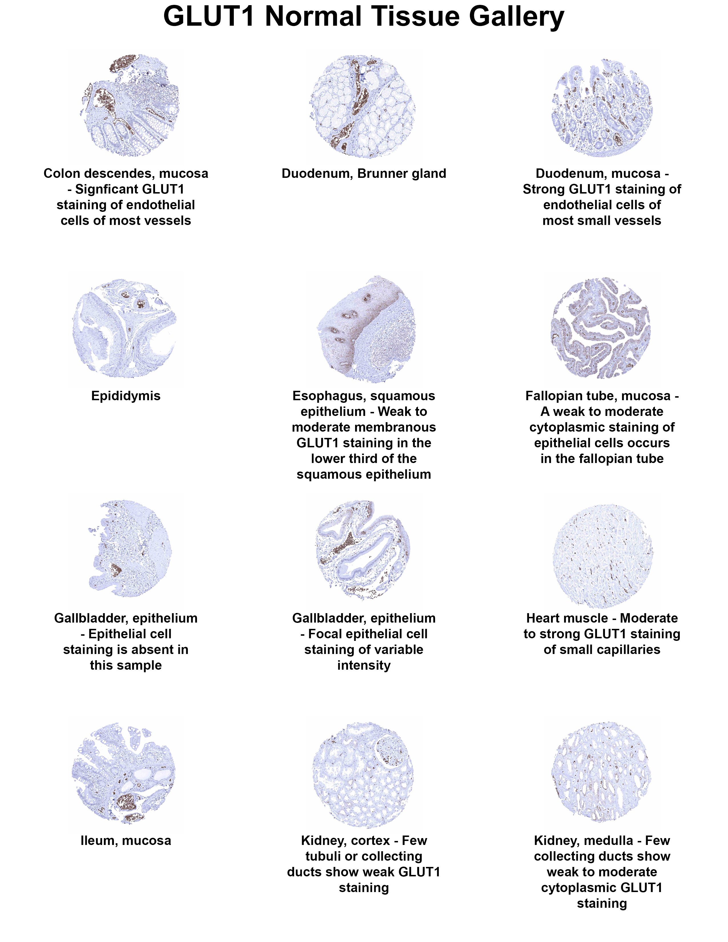 Glut1 Antibody (MSVA-401R) - Azide and BSA Free Glut1 Antibody (MSVA-401R) - Azide and BSA Free Glut1 Normal Tissue Gallery