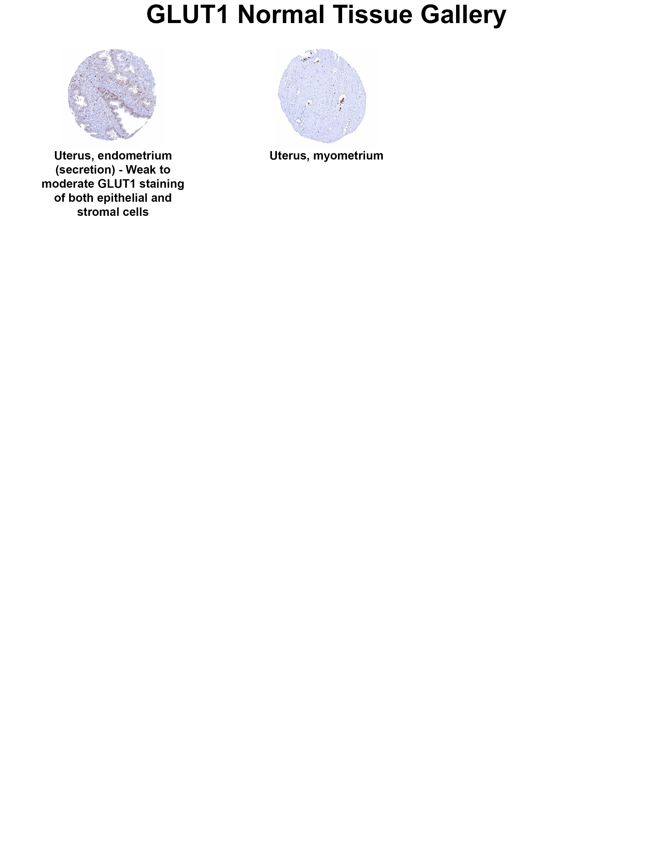 Glut1 Antibody (MSVA-401R) - Azide and BSA Free Glut1 Antibody (MSVA-401R) - Azide and BSA Free Glut1 Normal Tissue Gallery