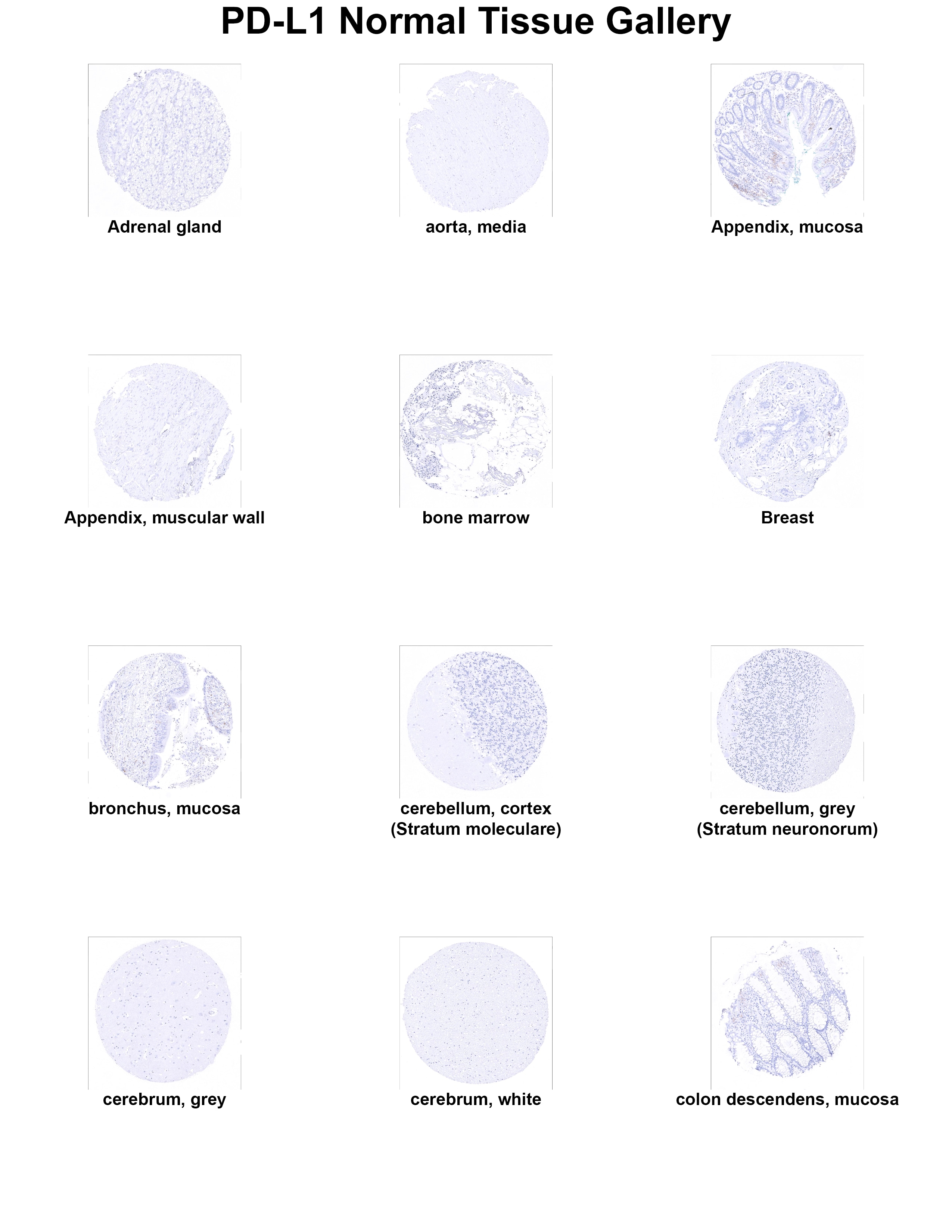 PD-L1 Antibody (MSVA-711R) - Azide and BSA Free PD-L1 Antibody (MSVA-711R) - Azide and BSA Free PD-L1 Normal Tissue Gallery