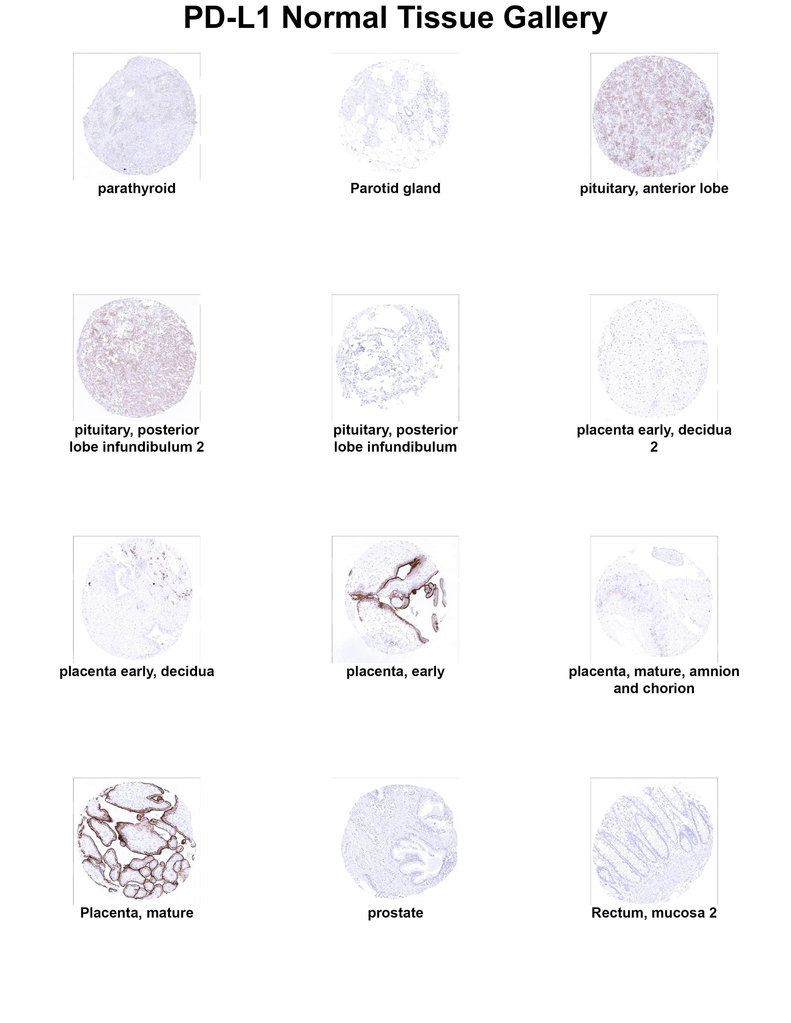PD-L1 Antibody (MSVA-711R) - Azide and BSA Free PD-L1 Antibody (MSVA-711R) - Azide and BSA Free PD-L1 Normal Tissue Gallery