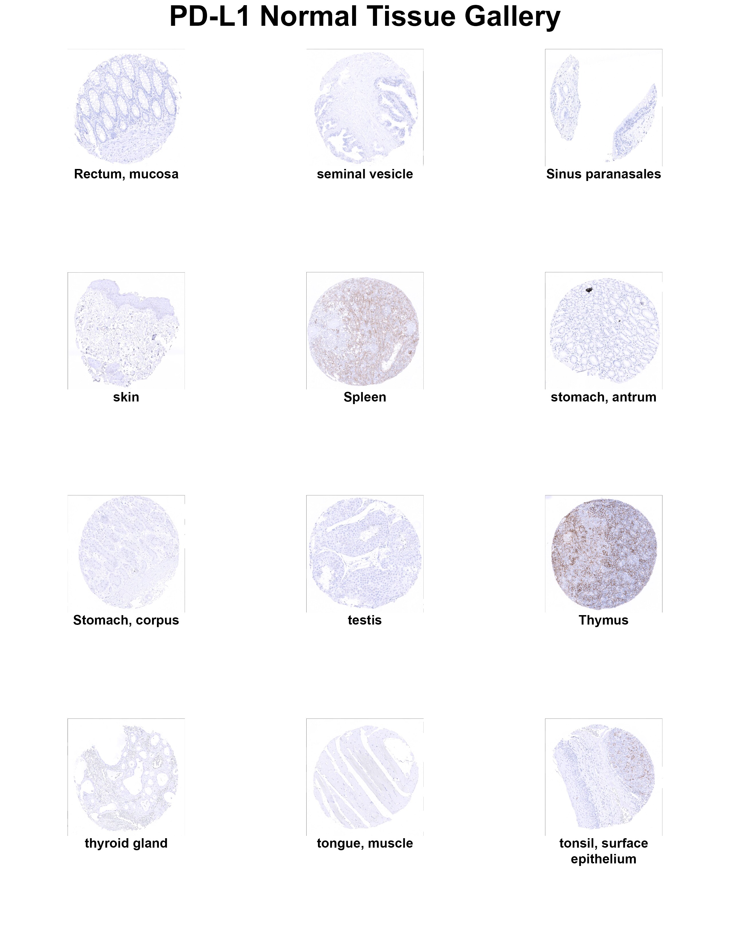 PD-L1 Antibody (MSVA-711R) - Azide and BSA Free PD-L1 Antibody (MSVA-711R) - Azide and BSA Free PD-L1 Normal Tissue Gallery