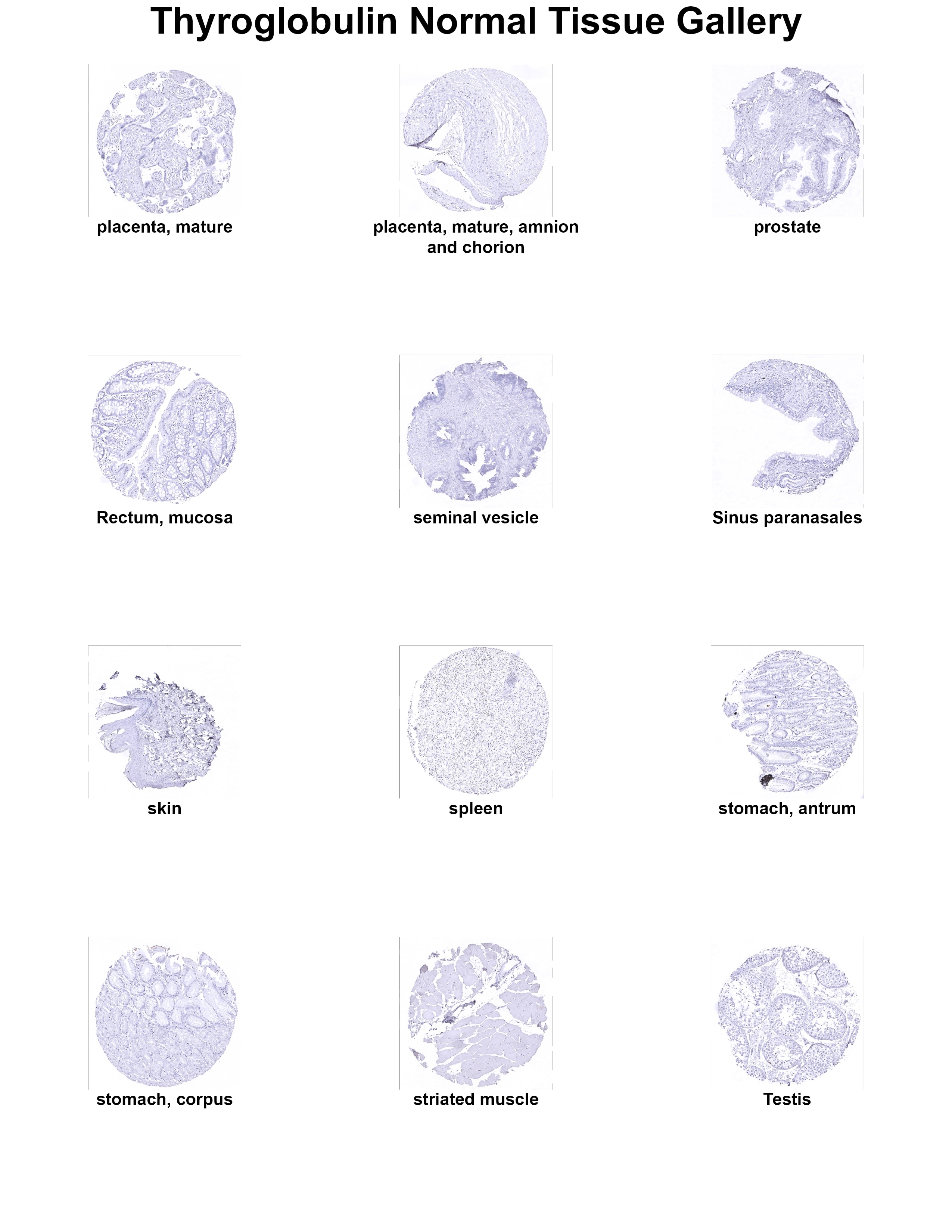Thyroglobulin Antibody (MSVA-189R) - Azide and BSA Free Thyroglobulin Antibody (MSVA-189R) - Azide and BSA Free Thyroglobulin Normal Tissue Gallery