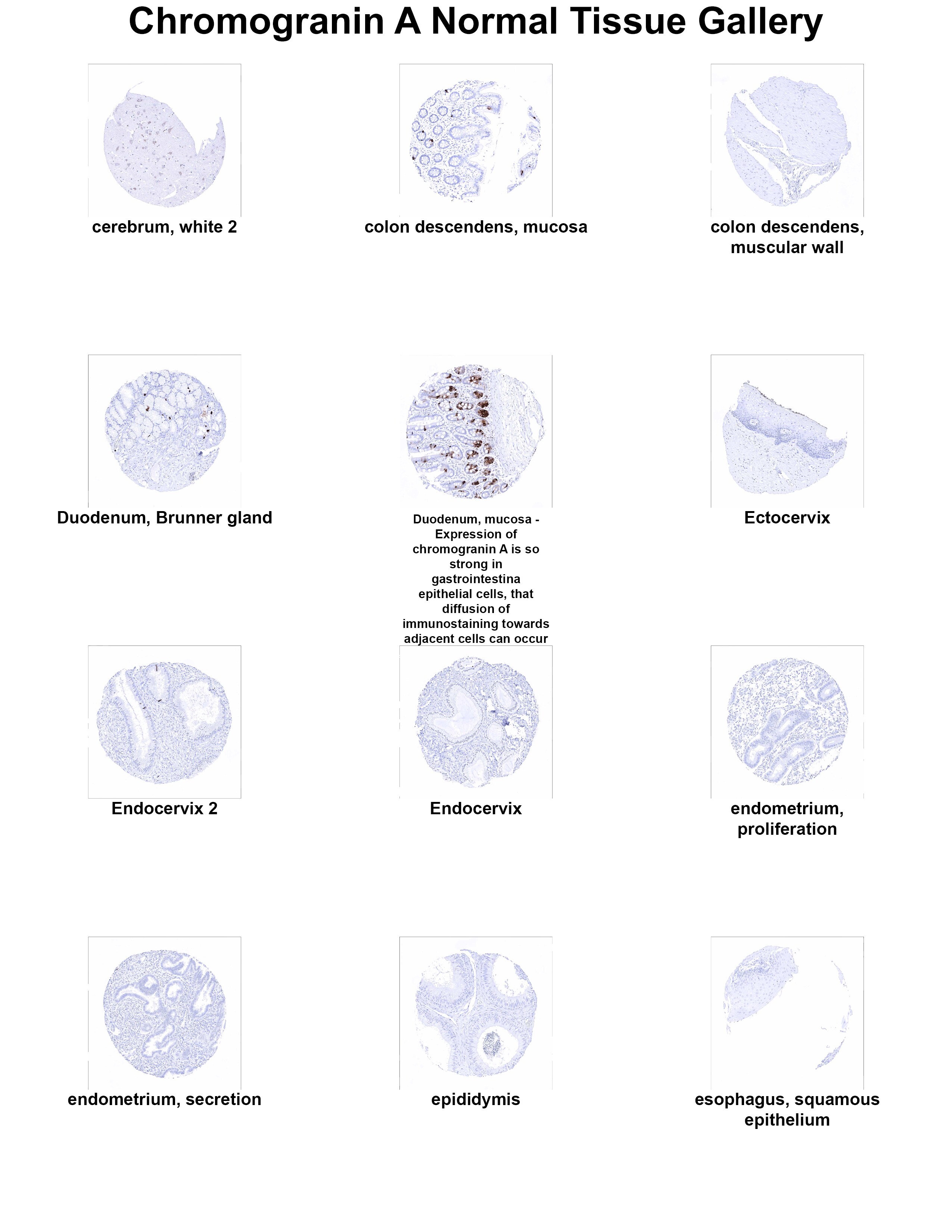 Chromogranin A Antibody (MSVA-380R) - Azide and BSA Free Chromogranin A Antibody (MSVA-380R) - Azide and BSA Free Chromogranin A Normal Tissue Gallery