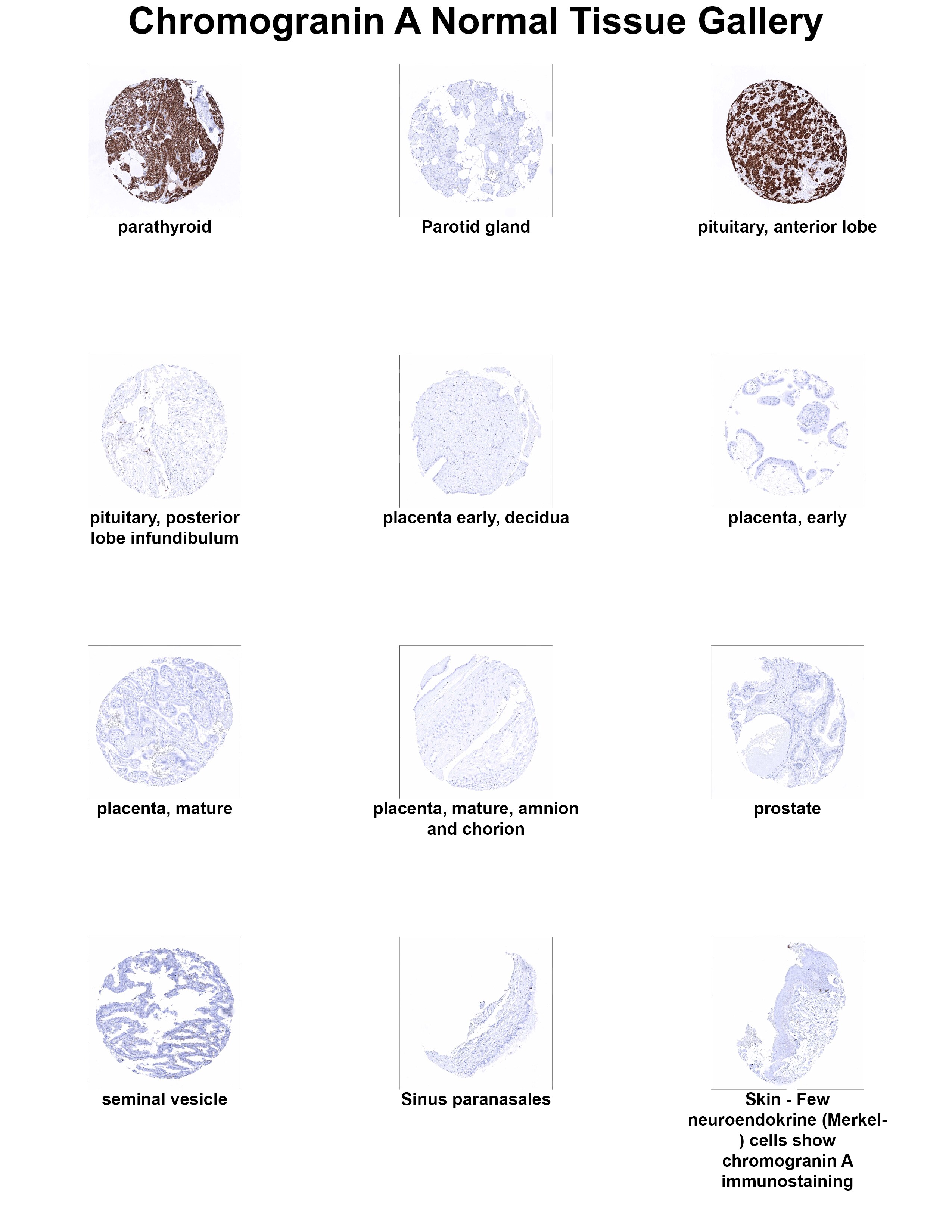 Chromogranin A Antibody (MSVA-380R) - Azide and BSA Free Chromogranin A Antibody (MSVA-380R) - Azide and BSA Free Chromogranin A Normal Tissue Gallery