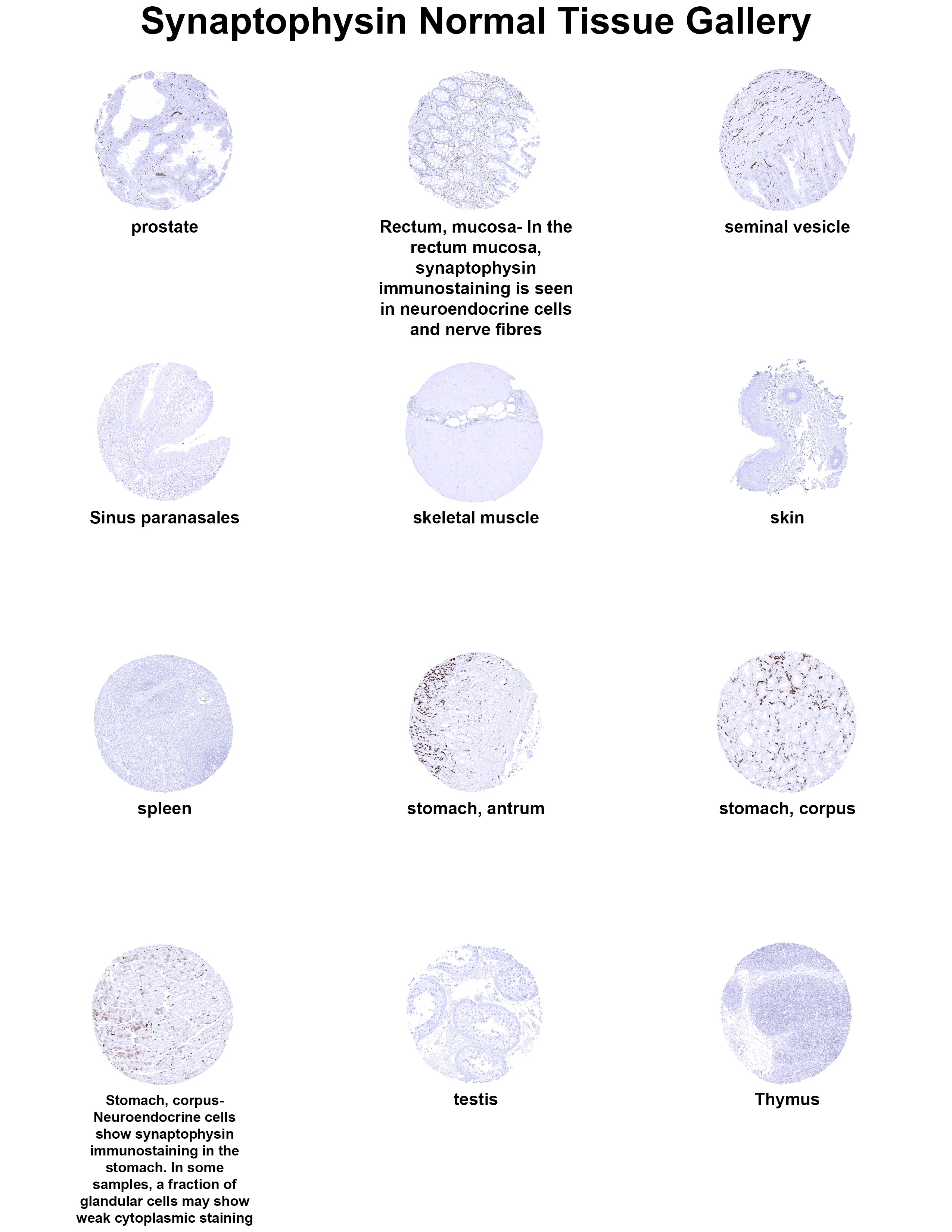 Synaptophysin Antibody (MSVA-462R) - Azide and BSA Free Synaptophysin Antibody (MSVA-462R) - Azide and BSA Free Synaptophysin Normal Tissue Gallery