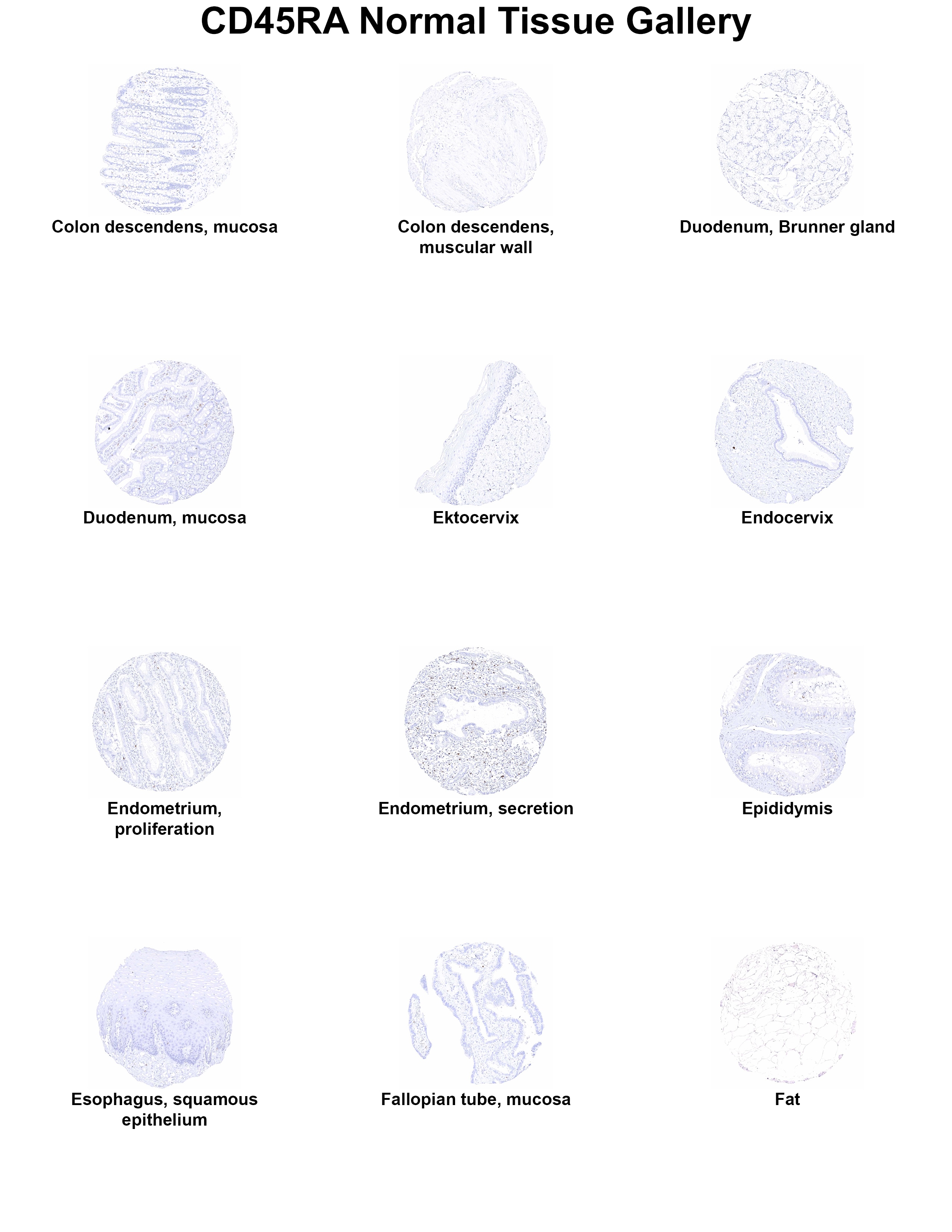 CD45RA Antibody (MSVA-472M) - Azide and BSA Free CD45RA Antibody (MSVA-472M) - Azide and BSA Free CD45RA Normal Tissue Gallery