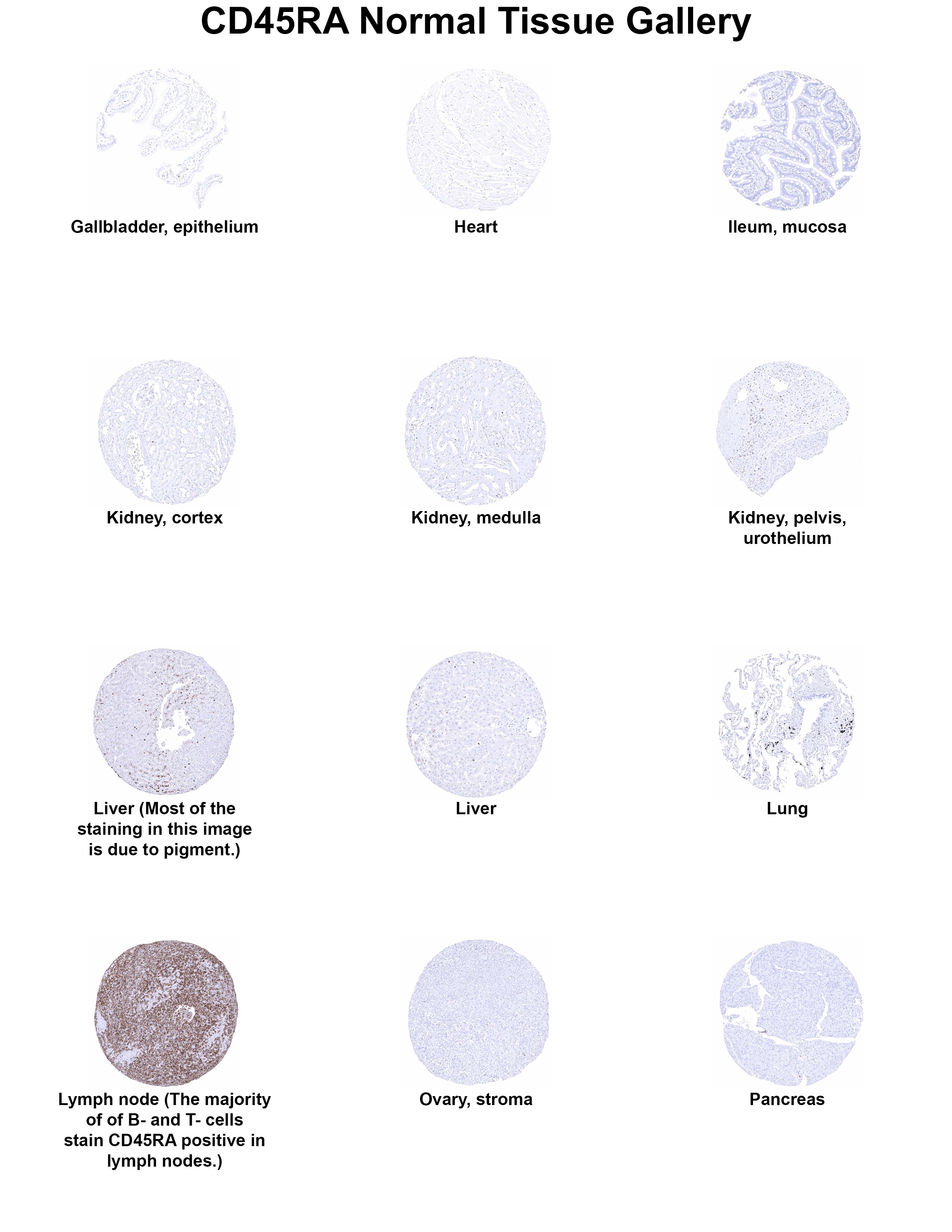 CD45RA Antibody (MSVA-472M) - Azide and BSA Free CD45RA Antibody (MSVA-472M) - Azide and BSA Free CD45RA Normal Tissue Gallery