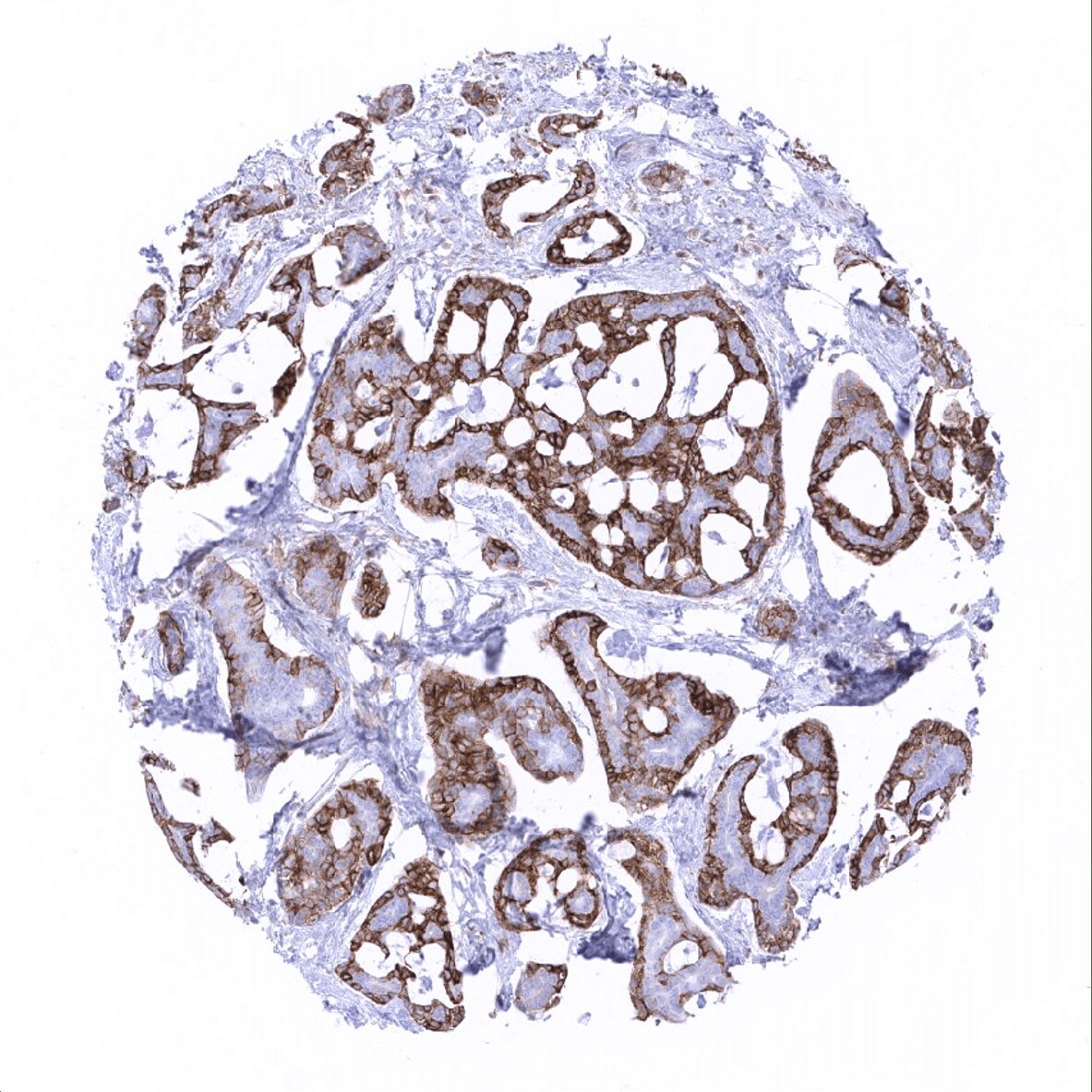 Mesothelin Antibody (MSVA-235M) - Azide and BSA Free
