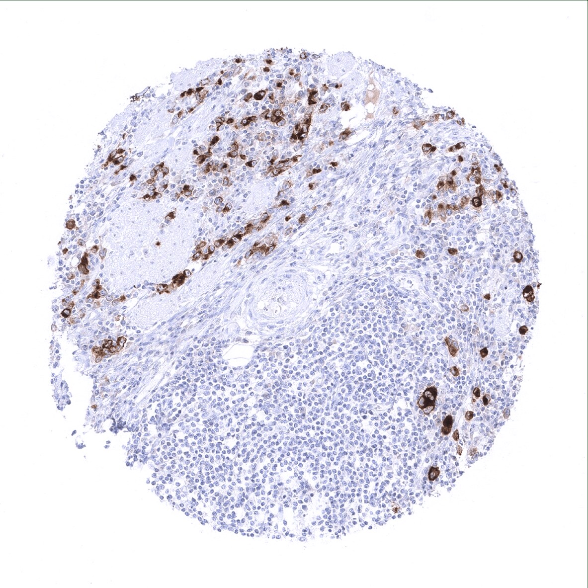 Mesothelin Antibody (MSVA-235M) - Azide and BSA Free