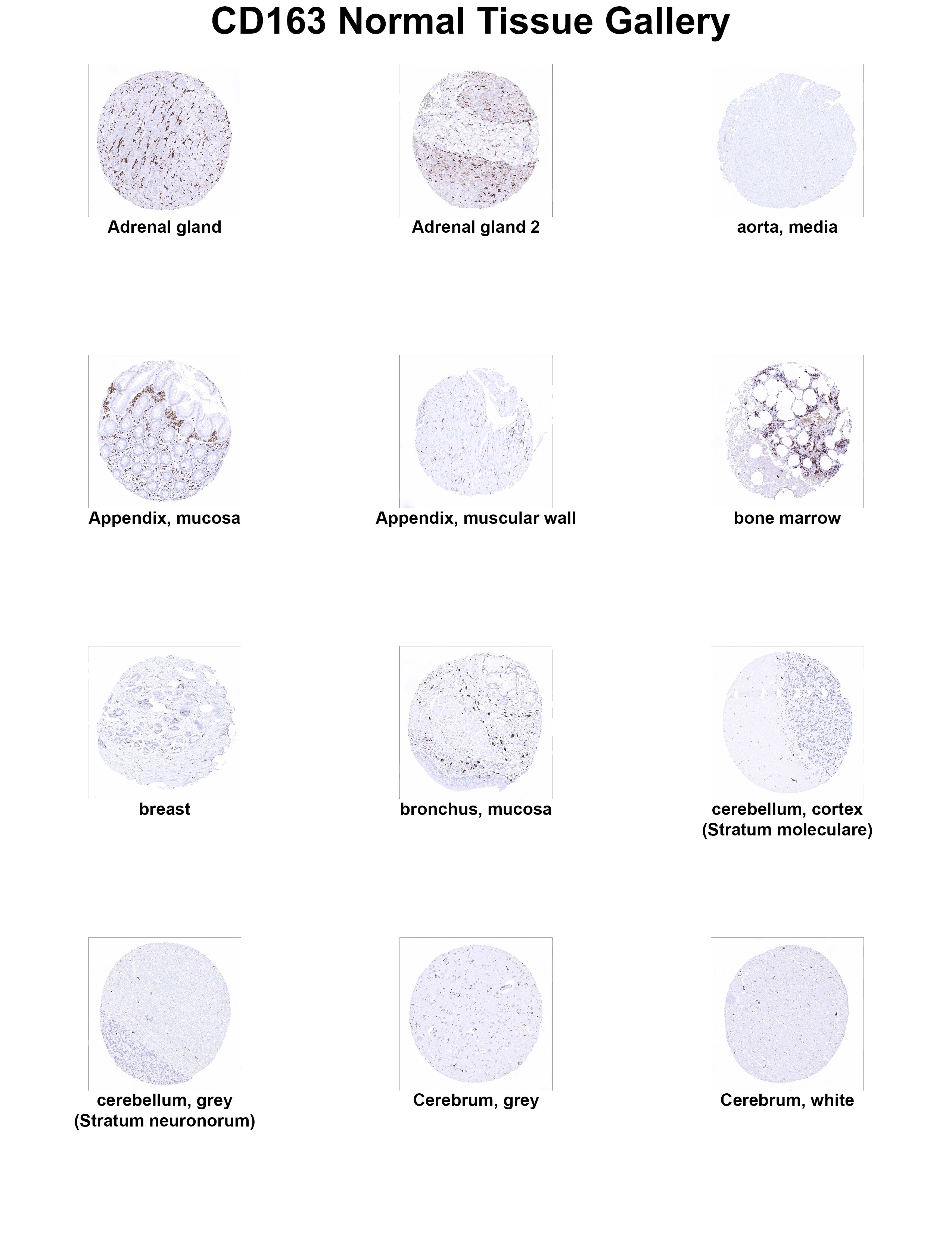 CD163 Antibody (MSVA-163M) - Azide and BSA Free CD163 Antibody (MSVA-163M) - Azide and BSA Free CD163 Normal Tissue Gallery