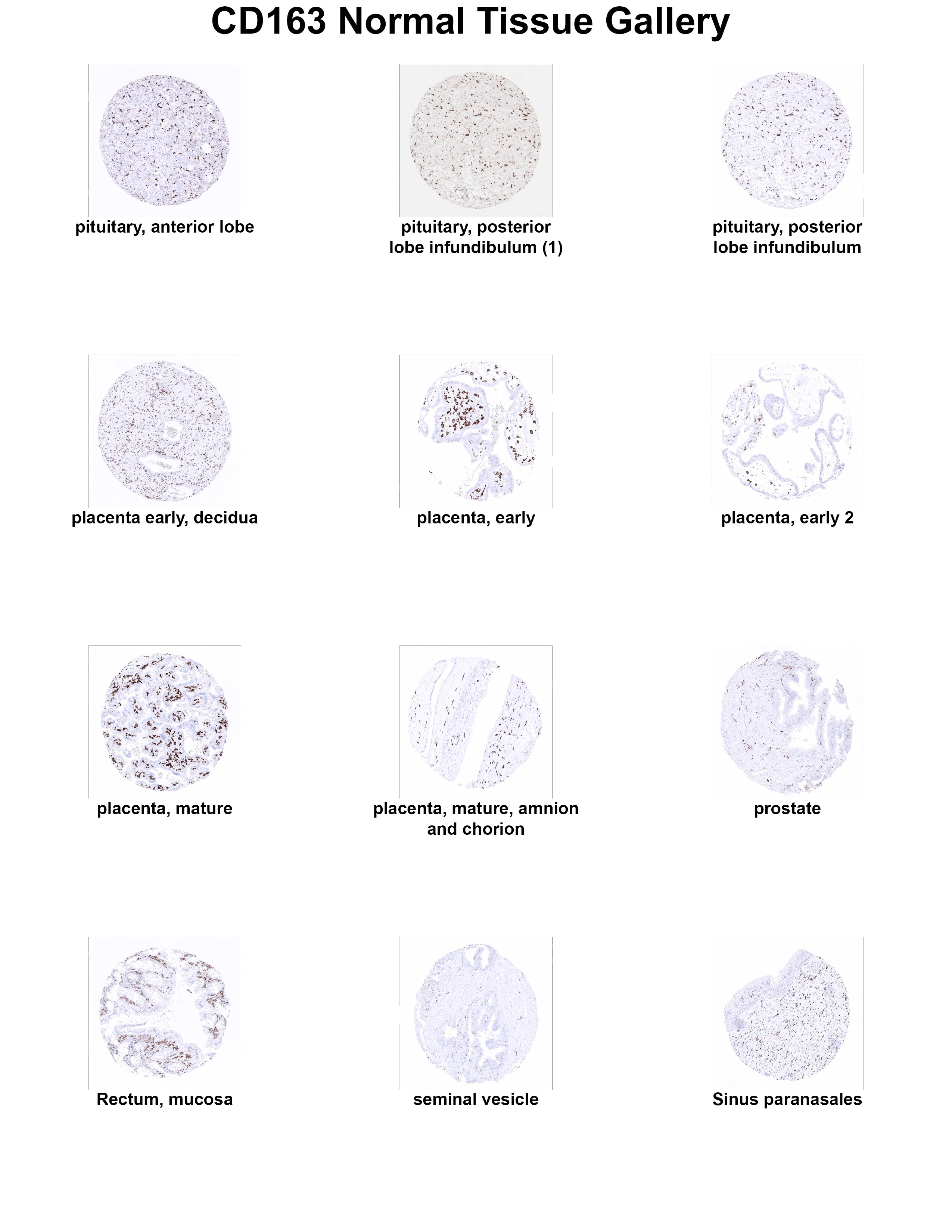 CD163 Antibody (MSVA-163M) - Azide and BSA Free CD163 Antibody (MSVA-163M) - Azide and BSA Free CD163 Normal Tissue Gallery