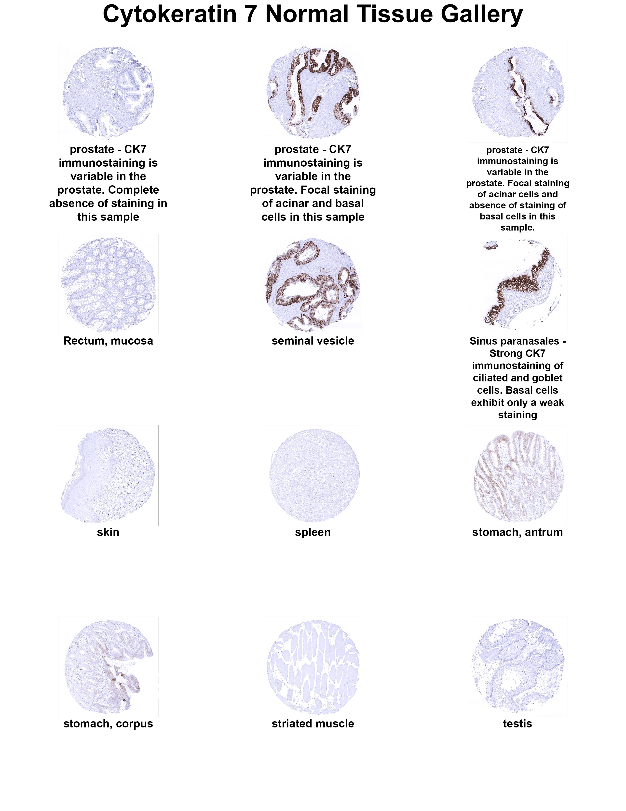 Cytokeratin 7 Antibody (MSVA-607R) - Azide and BSA Free Cytokeratin 7 Antibody (MSVA-607R) - Azide and BSA Free Cytokeratin 7 Normal Tissue Gallery