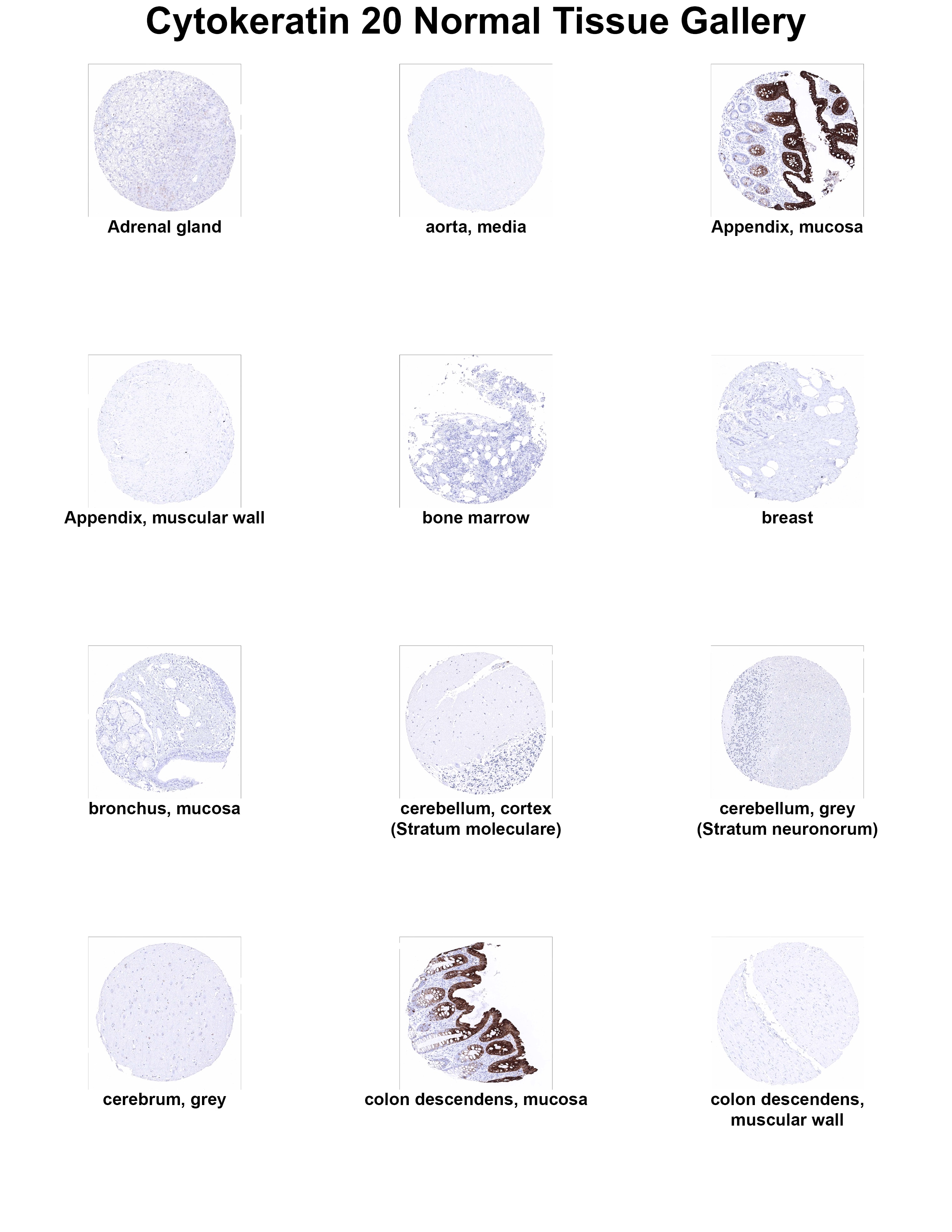 Cytokeratin 20 Antibody (MSVA-620R) - Azide and BSA Free Cytokeratin 20 Antibody (MSVA-620R) - Azide and BSA Free Cytokeratin 20 Normal Tissue Gallery