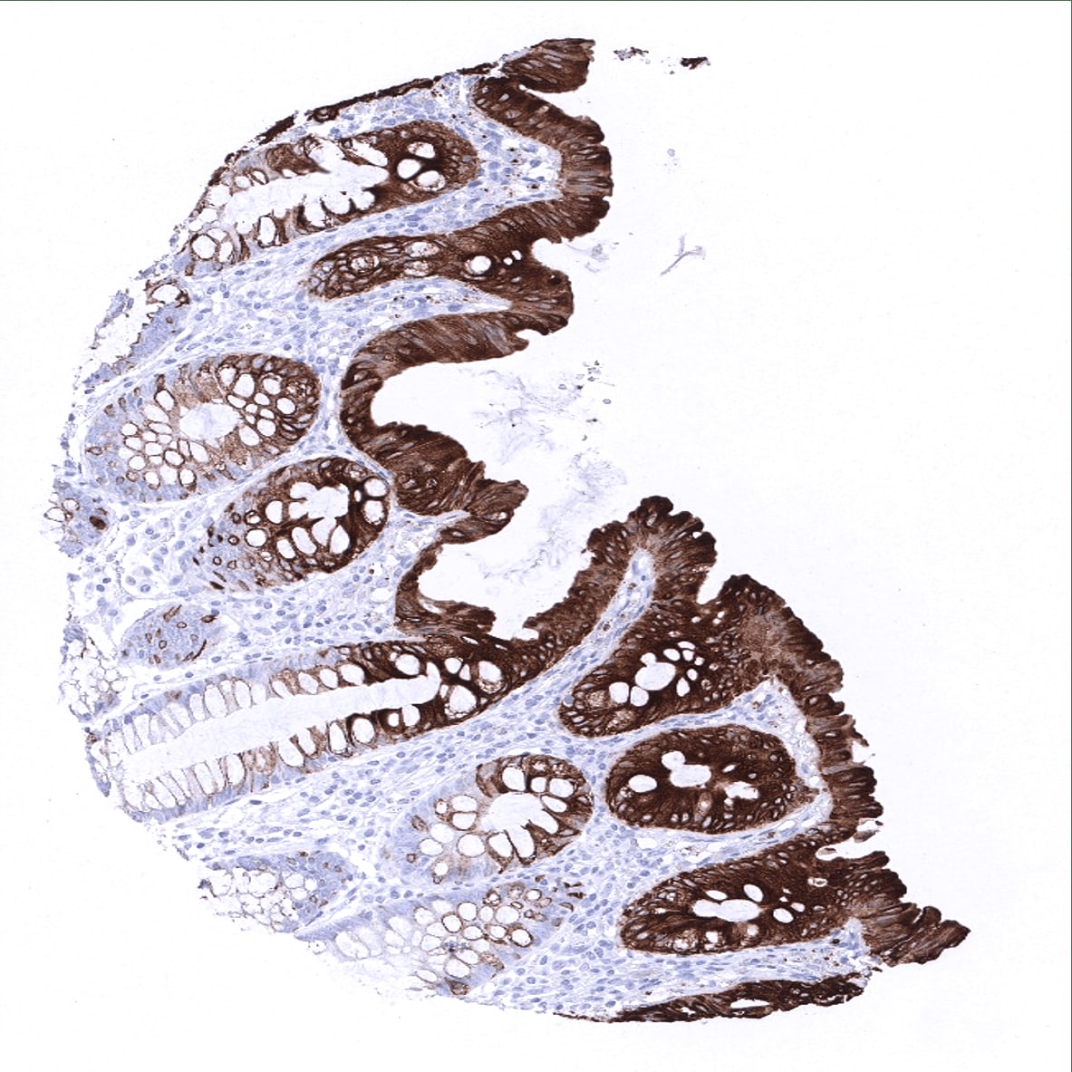 Cytokeratin 20 Antibody (MSVA-620R) - Azide and BSA Free