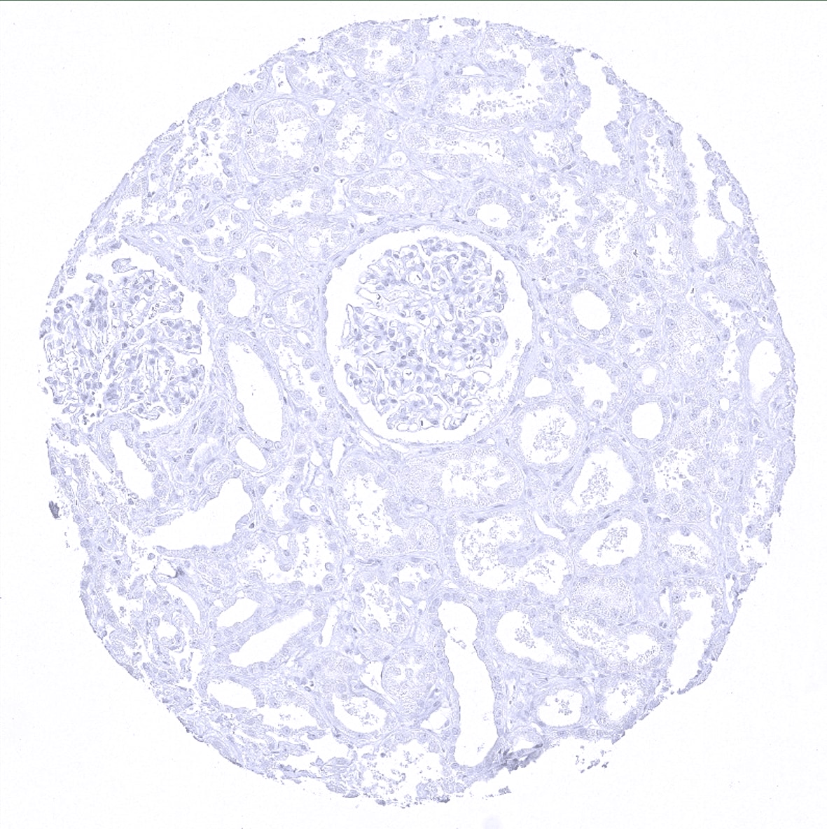 Cytokeratin 20 Antibody (MSVA-620R) - Azide and BSA Free