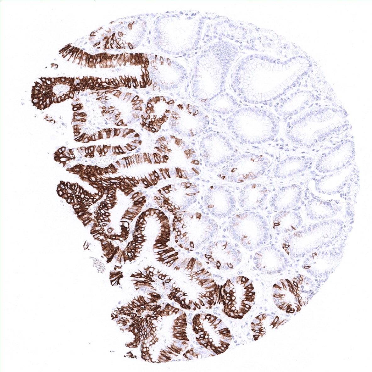 Cytokeratin 20 Antibody (MSVA-620R) - Azide and BSA Free