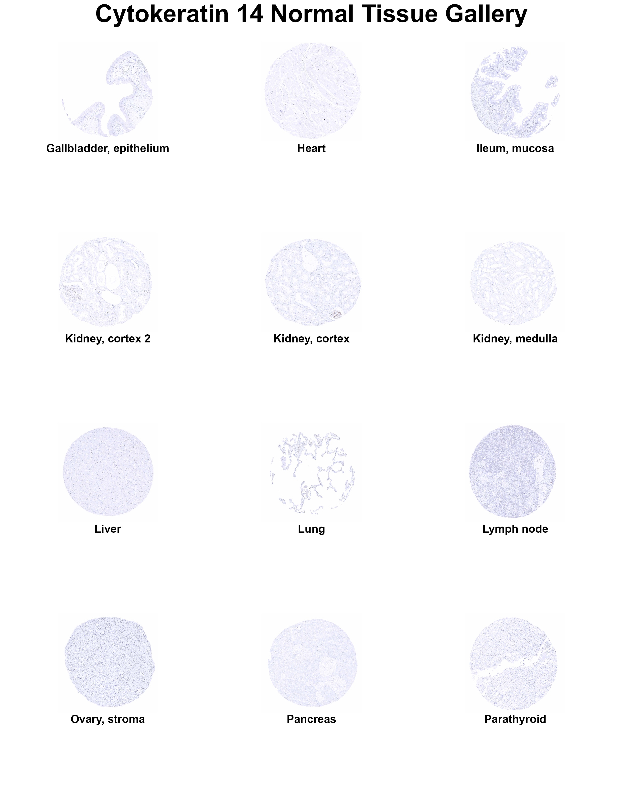 Cytokeratin 14 Antibody (MSVA-614R) - Azide and BSA Free Cytokeratin 14 Antibody (MSVA-614R) - Azide and BSA Free Cytokeratin 14 Normal Tissue Gallery