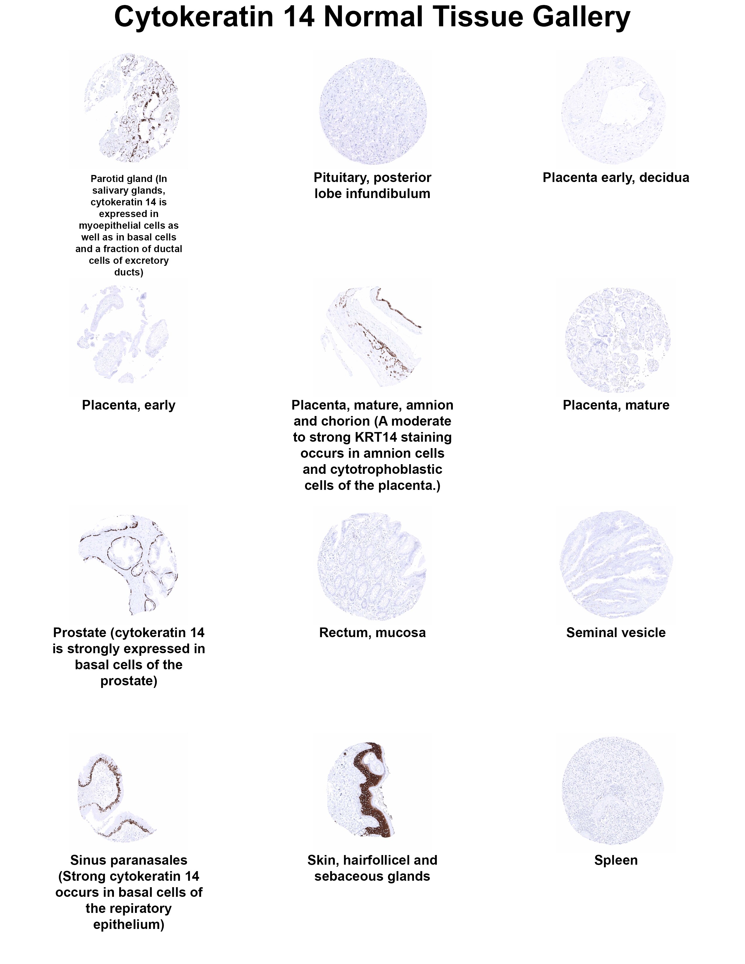 Cytokeratin 14 Antibody (MSVA-614R) - Azide and BSA Free Cytokeratin 14 Antibody (MSVA-614R) - Azide and BSA Free Cytokeratin 14 Normal Tissue Gallery