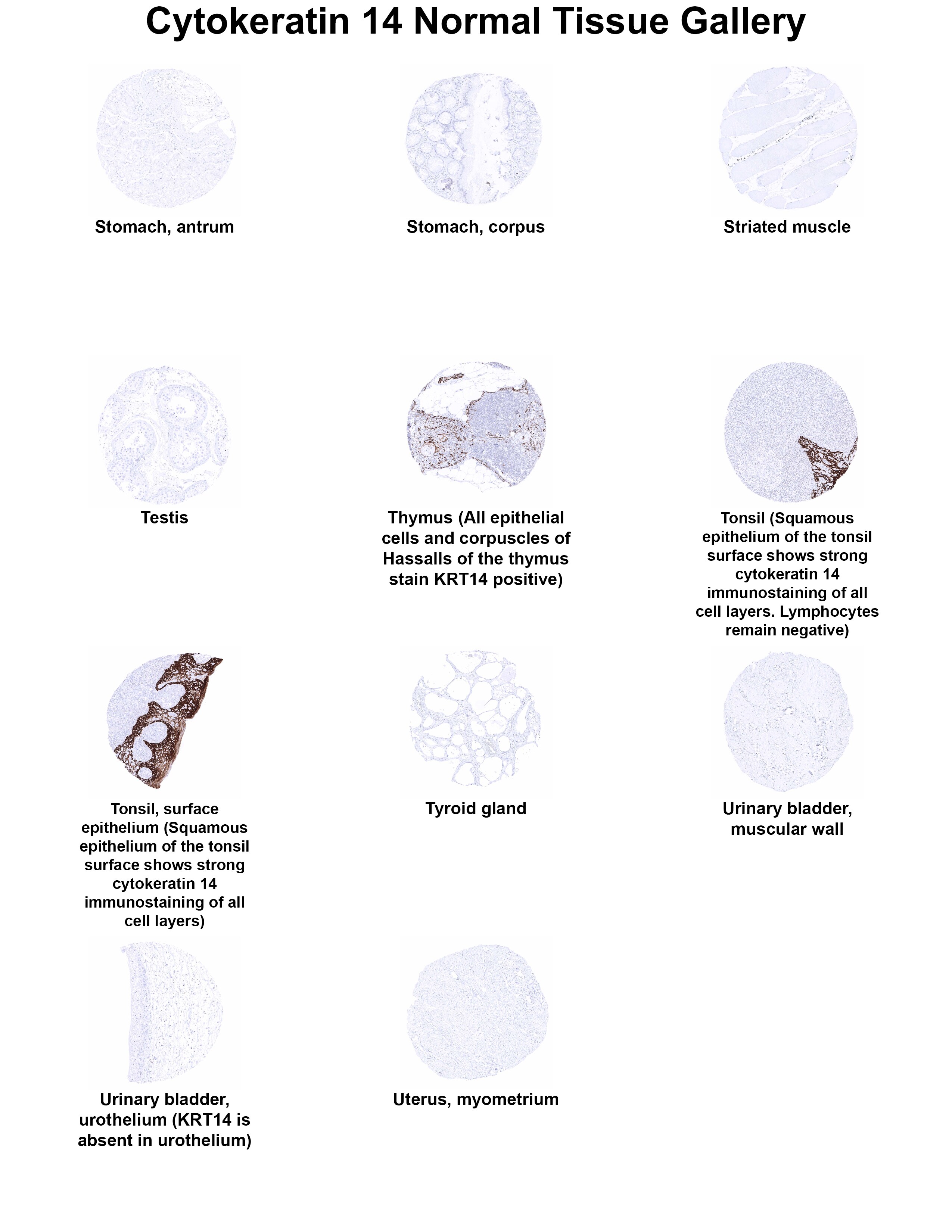Cytokeratin 14 Antibody (MSVA-614R) - Azide and BSA Free Cytokeratin 14 Antibody (MSVA-614R) - Azide and BSA Free Cytokeratin 14 Normal Tissue Gallery