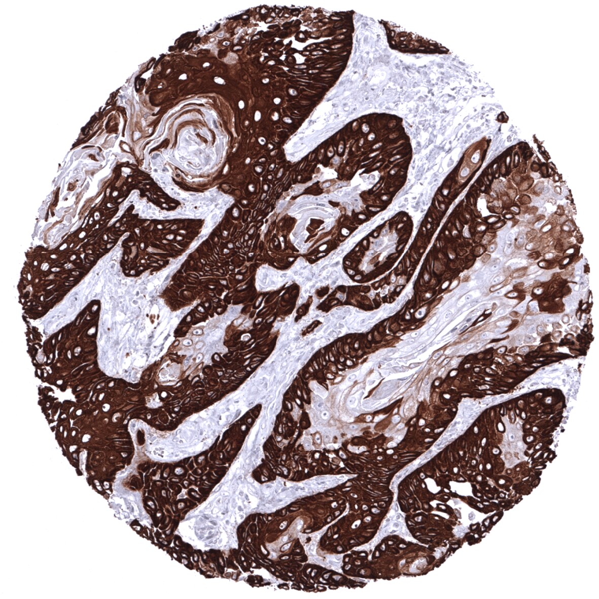 Cytokeratin 14 Antibody (MSVA-614R) - Azide and BSA Free