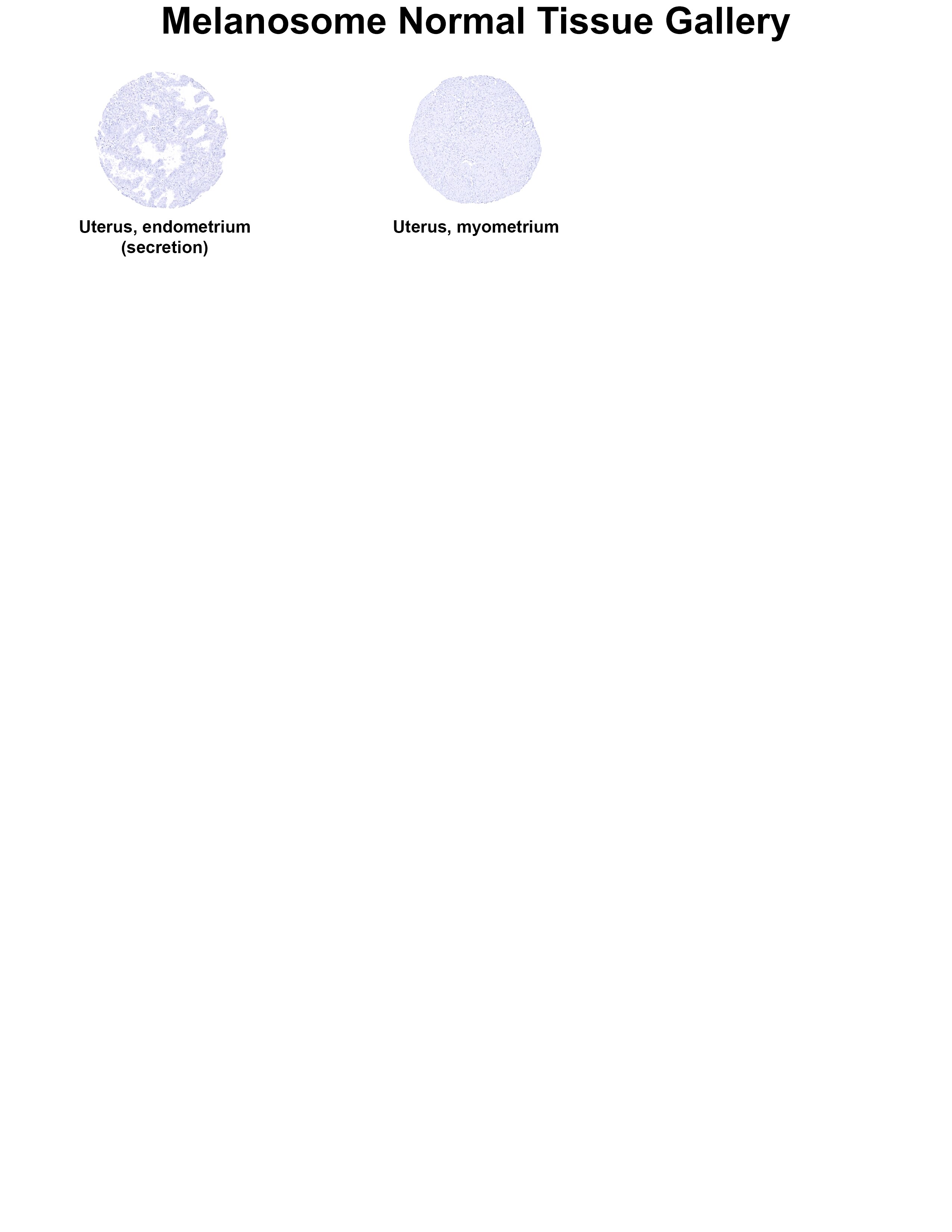 PMEL17/SILV Antibody (MSVA-617R) - Azide and BSA Free PMEL17/SILV Antibody (MSVA-617R) - Azide and BSA Free PMEL17/SILV Normal Tissue Gallery