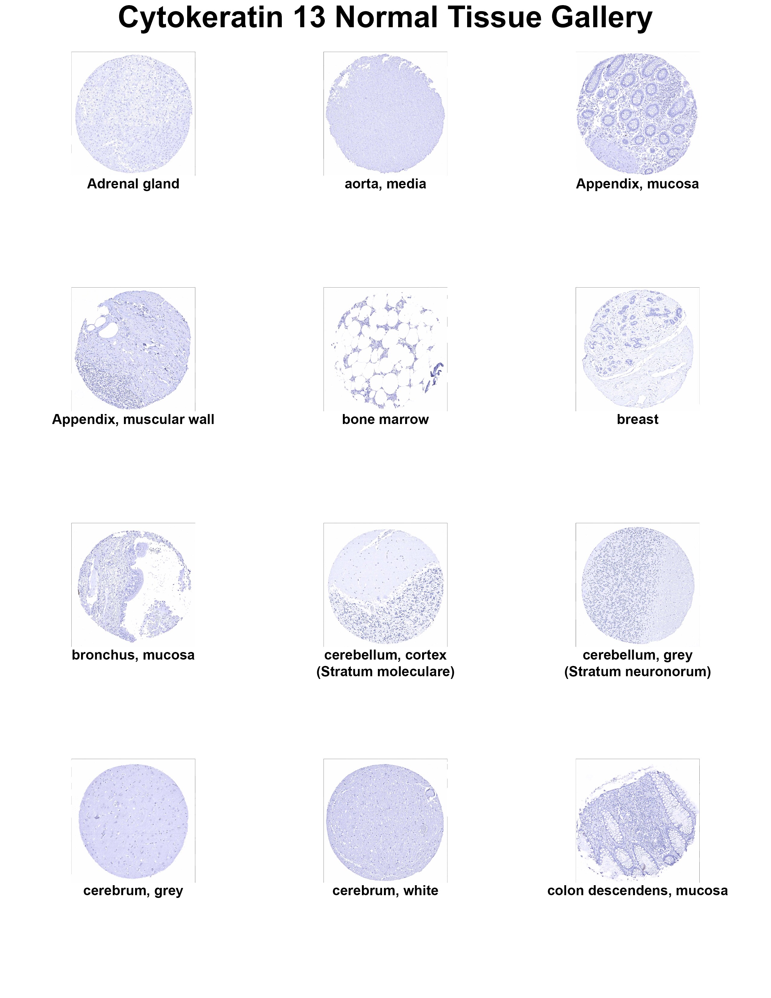 Cytokeratin 13 Antibody (MSVA-613M) - Azide and BSA Free Cytokeratin 13 Antibody (MSVA-613M) - Azide and BSA Free Cytokeratin 13 Normal Tissue Gallery