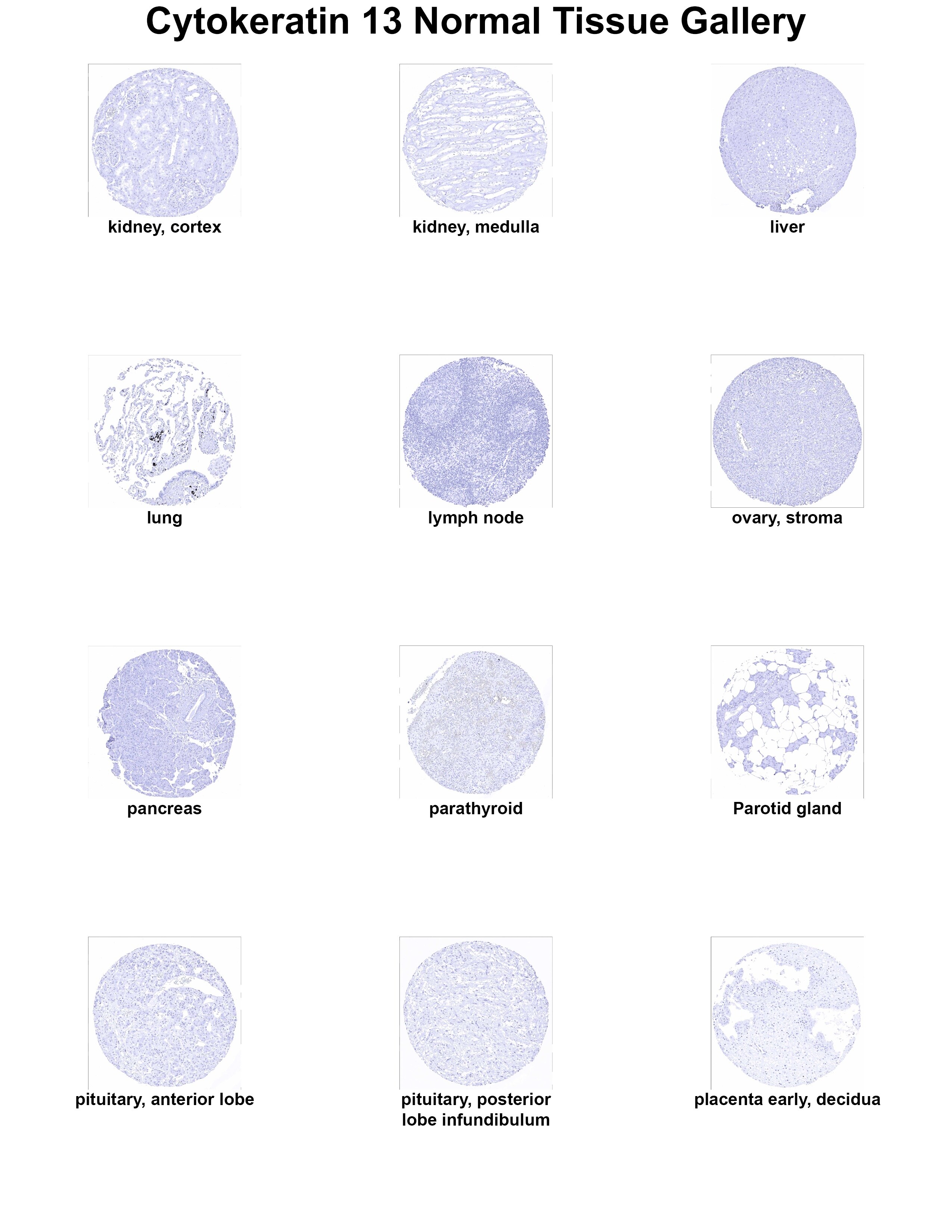 Cytokeratin 13 Antibody (MSVA-613M) - Azide and BSA Free Cytokeratin 13 Antibody (MSVA-613M) - Azide and BSA Free Cytokeratin 13 Normal Tissue Gallery